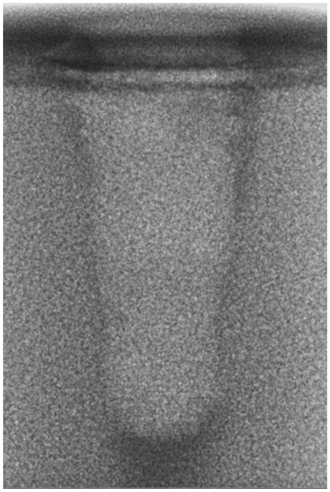 Bioengineering 11 00383 g006