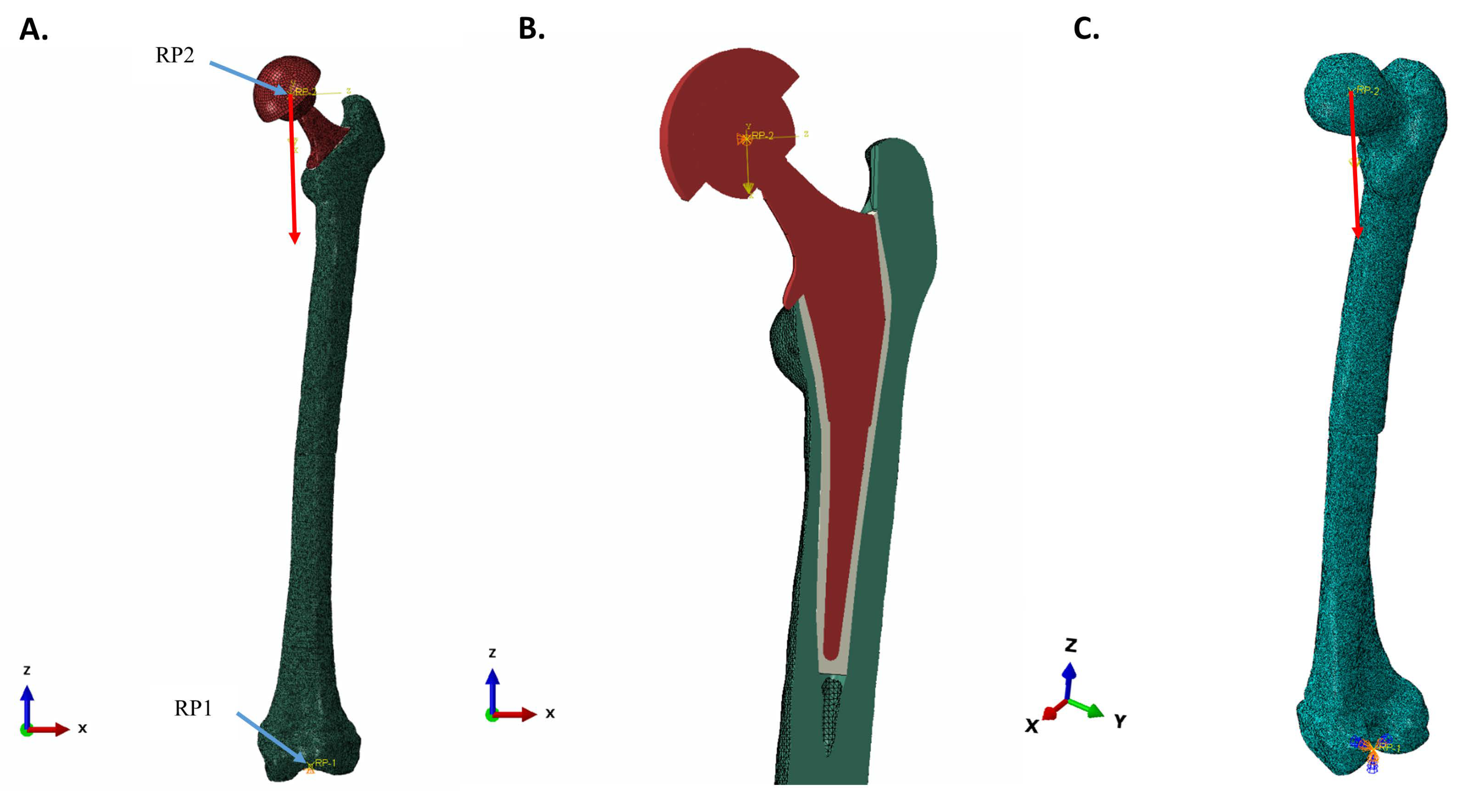 Bioengineering 11 00393 g001