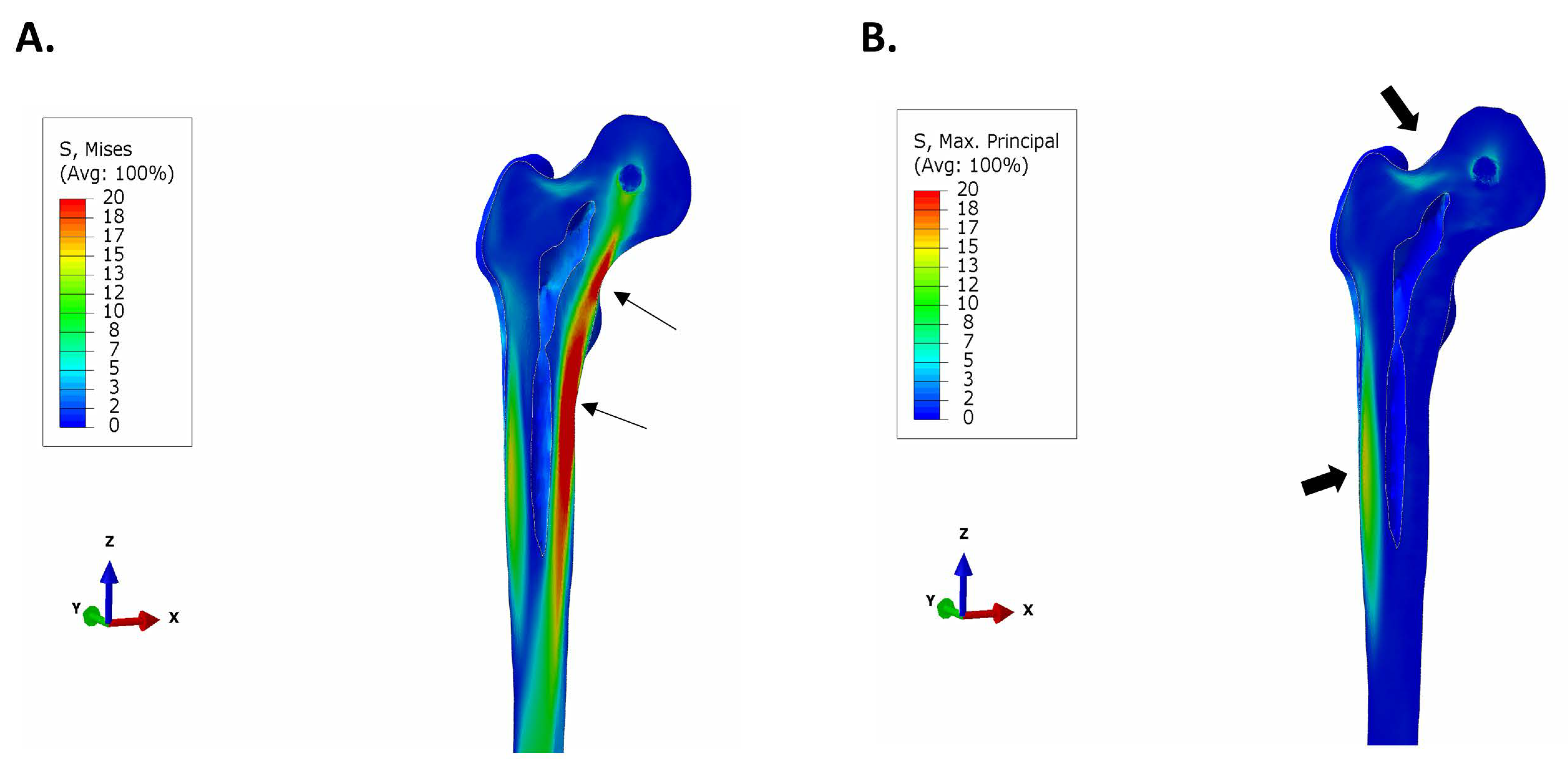 Bioengineering 11 00393 g003