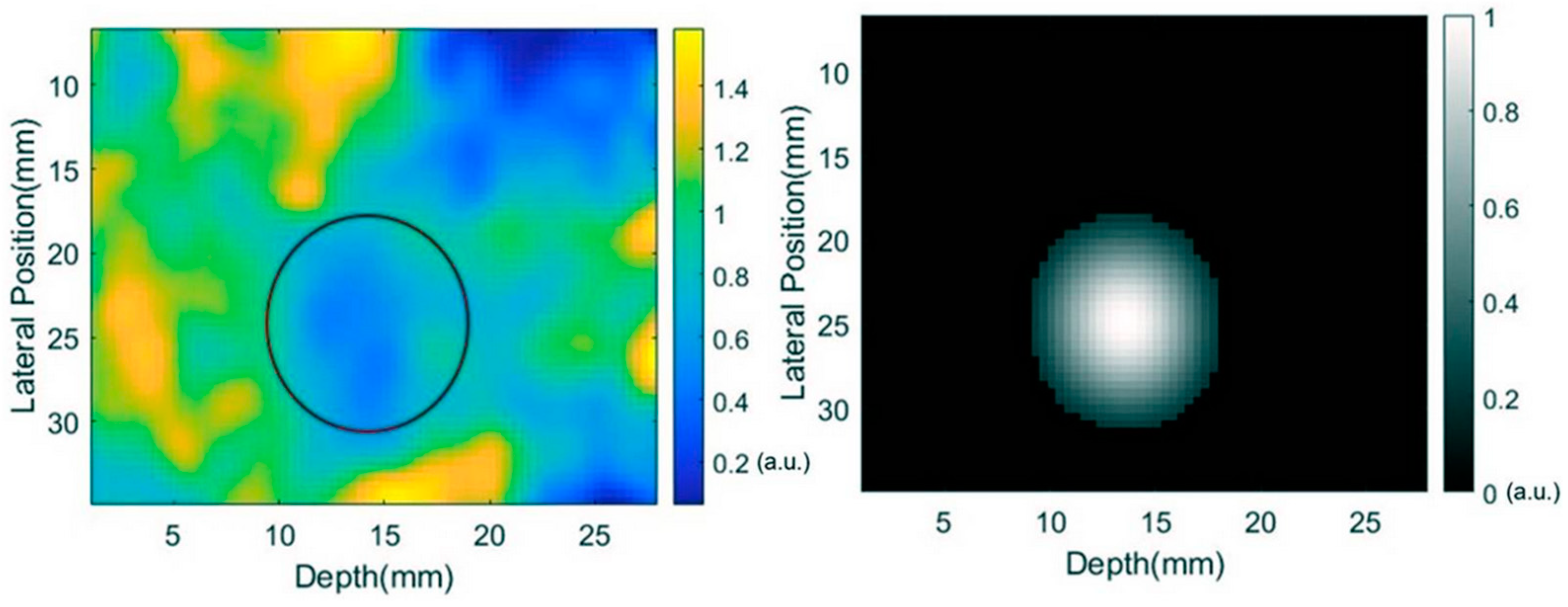 Bioengineering | Free Full-Text | Design Optimization and Tradeoff ...