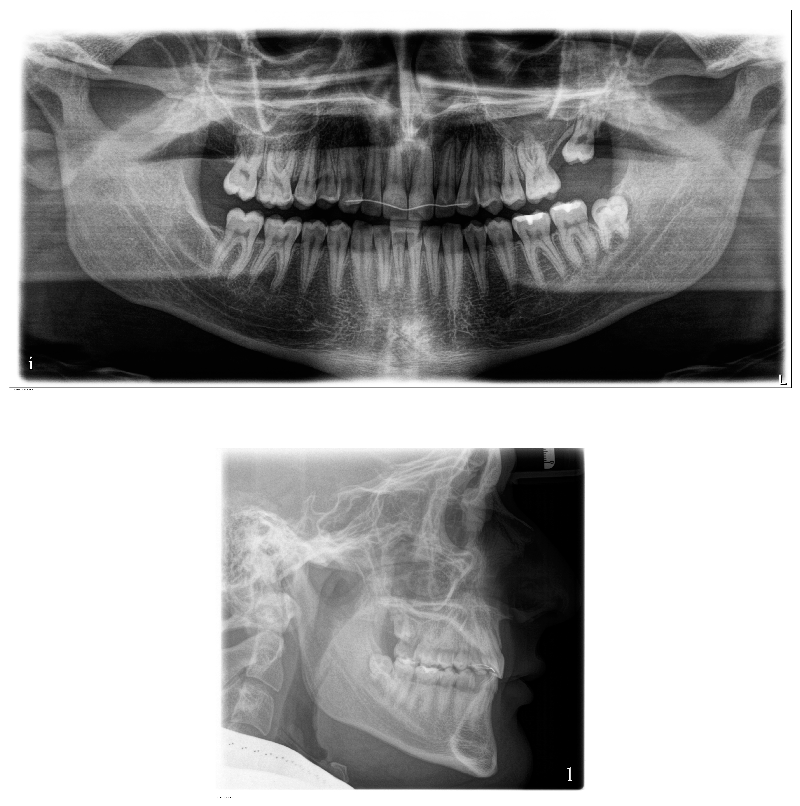 Bioengineering 11 00450 g007b
