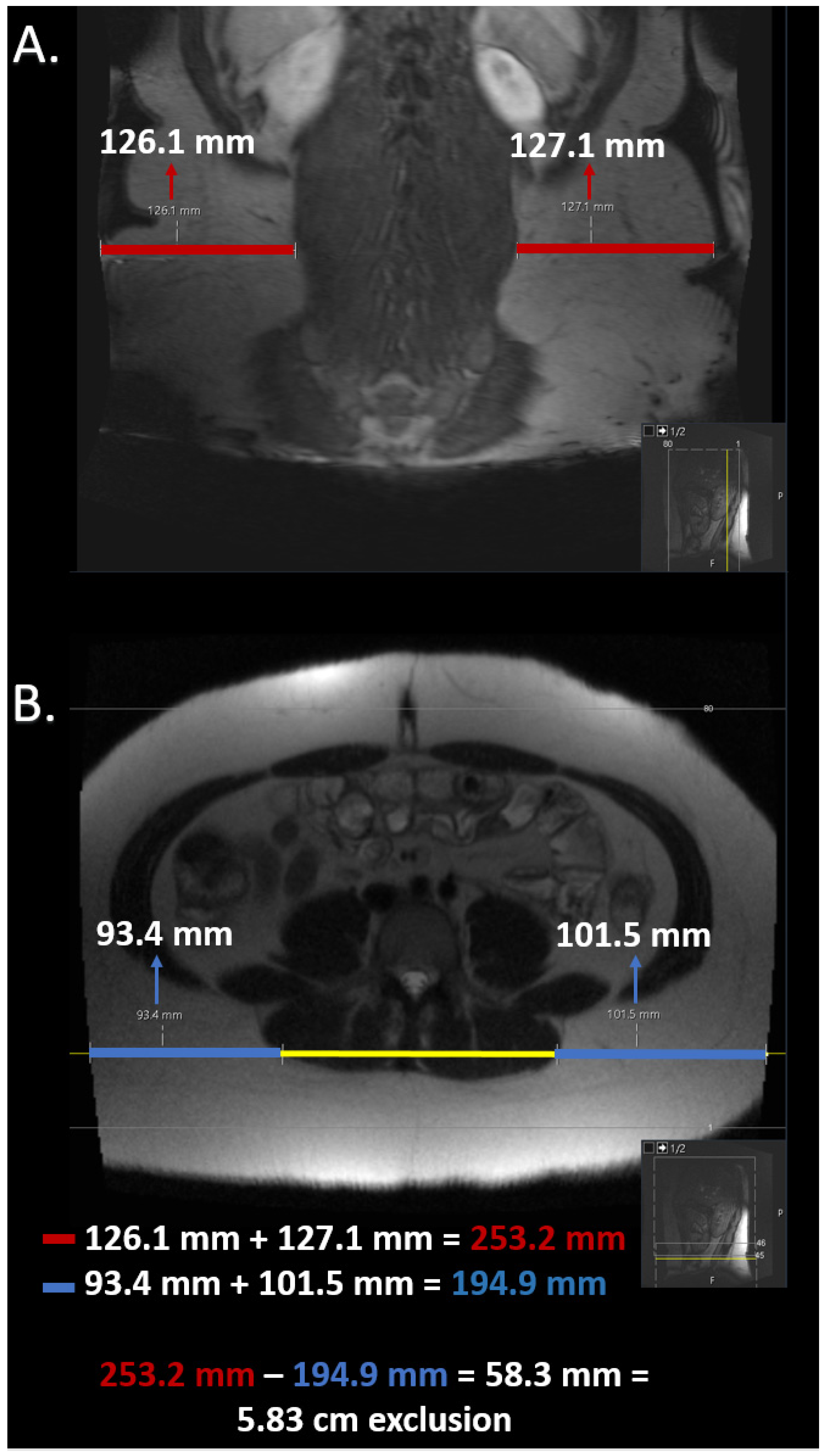 Bioengineering 11 00528 g002