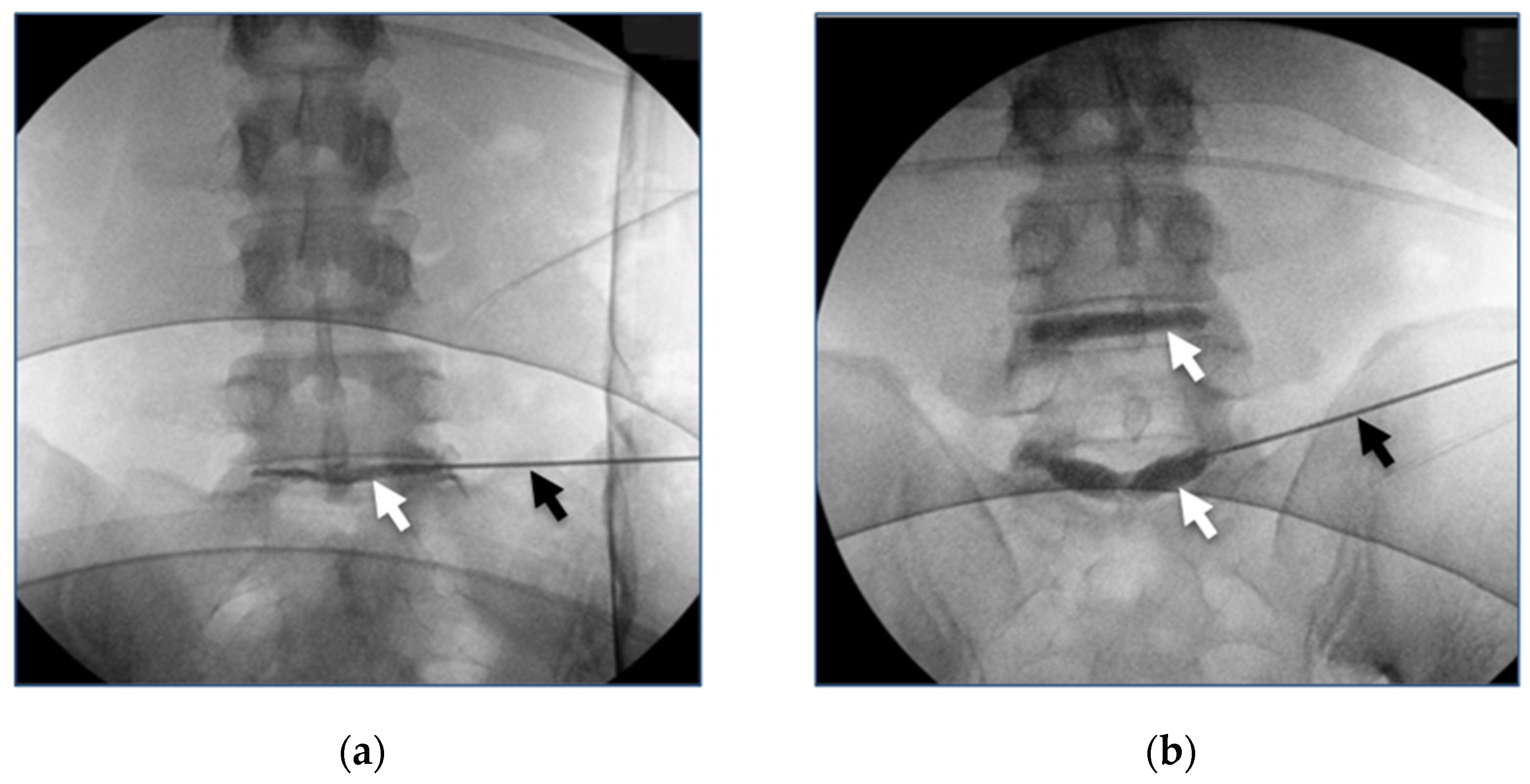Bioengineering 11 00535 g003
