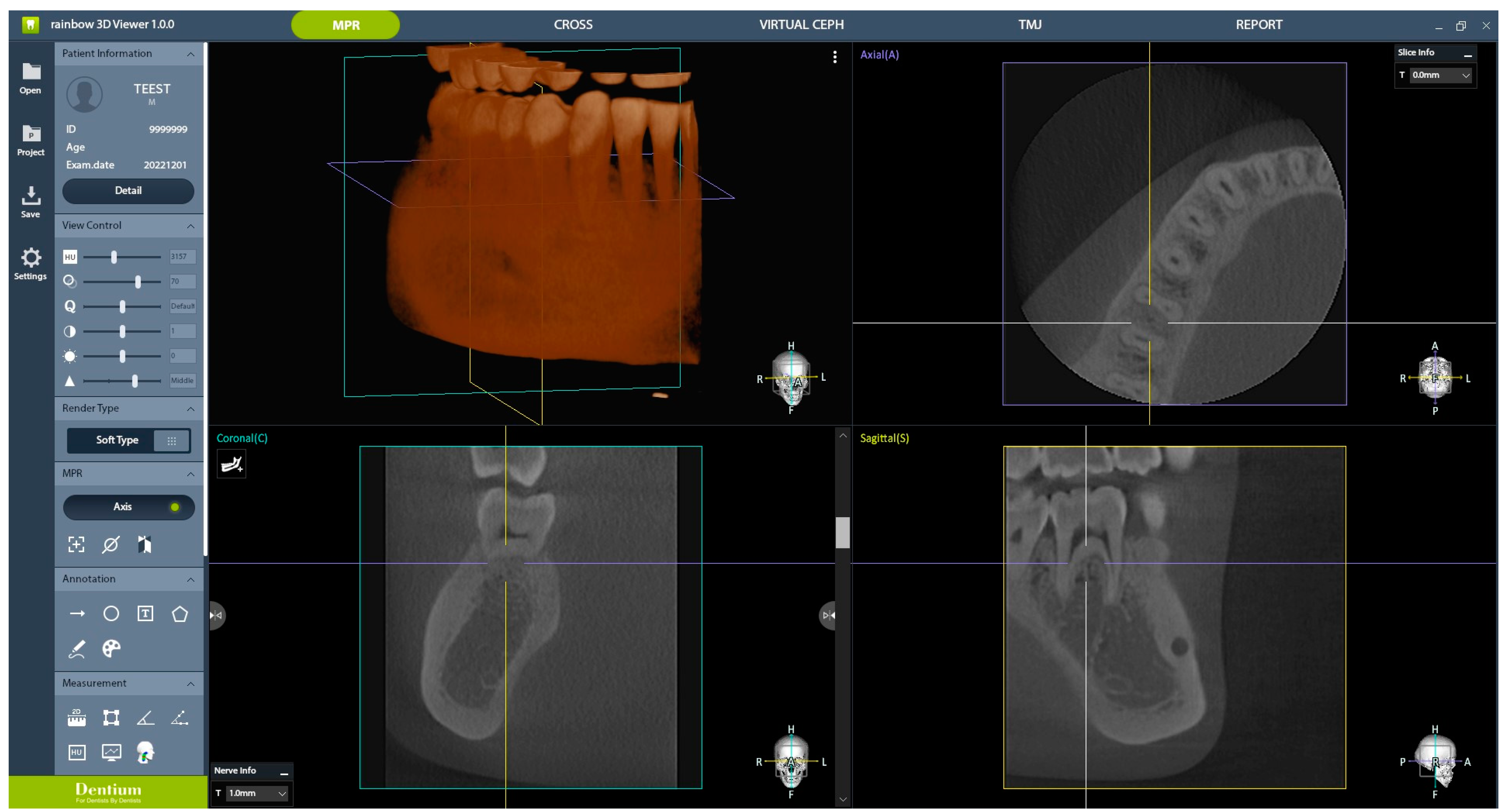Bioengineering 11 00576 g004
