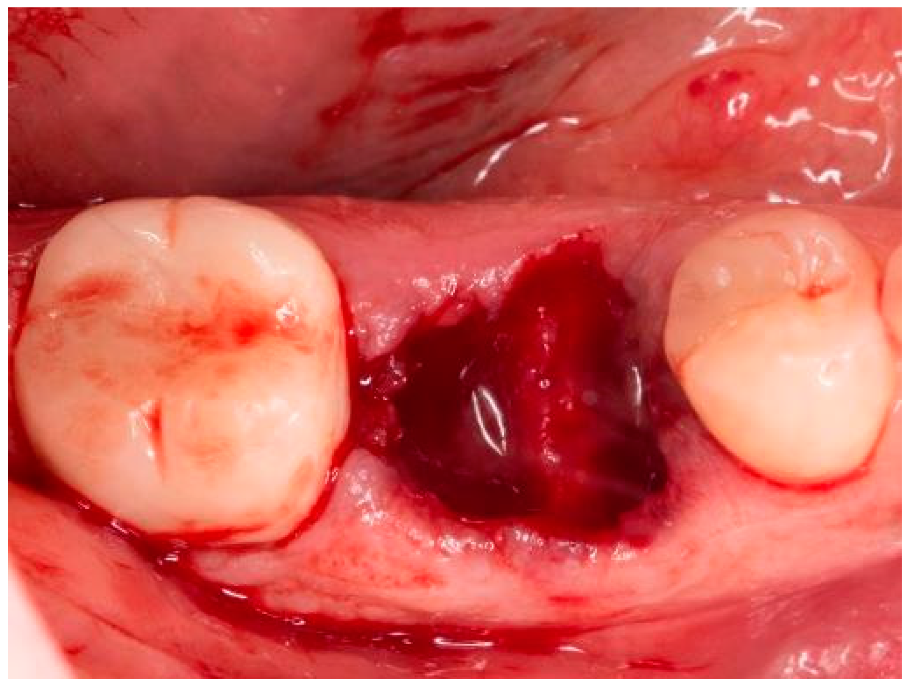 Bioengineering 11 00665 g001