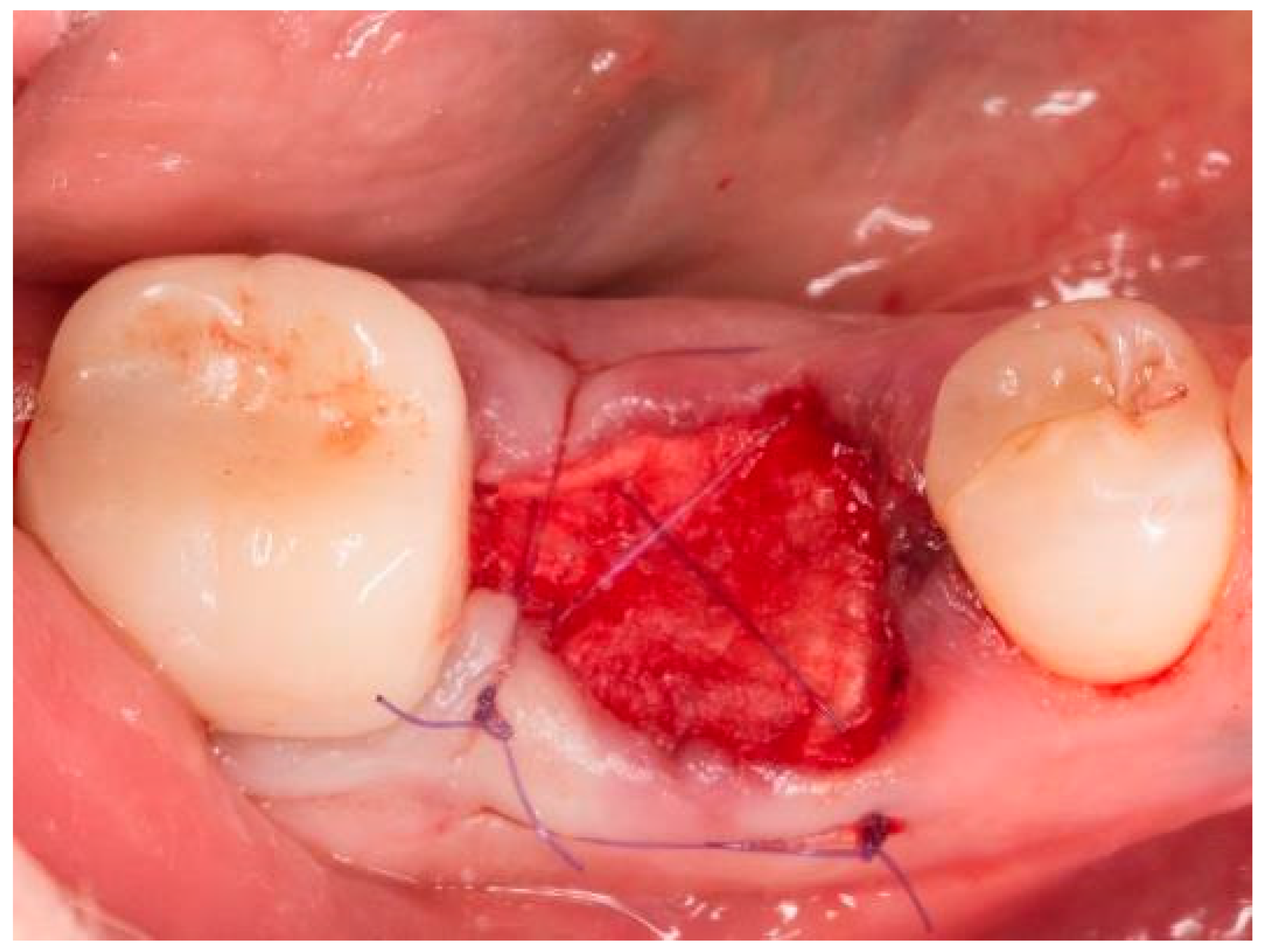 Bioengineering 11 00665 g004