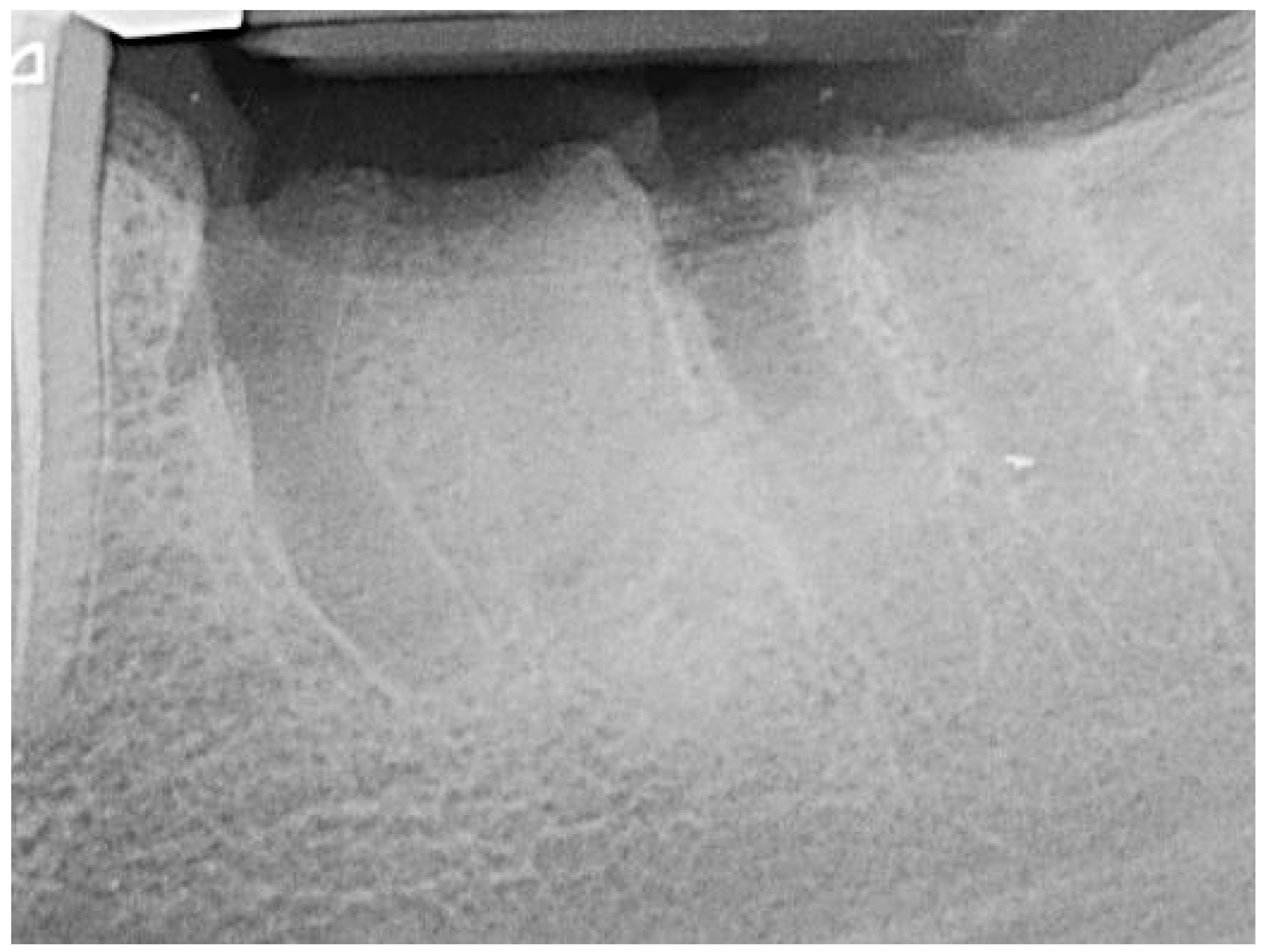 Bioengineering 11 00665 g005