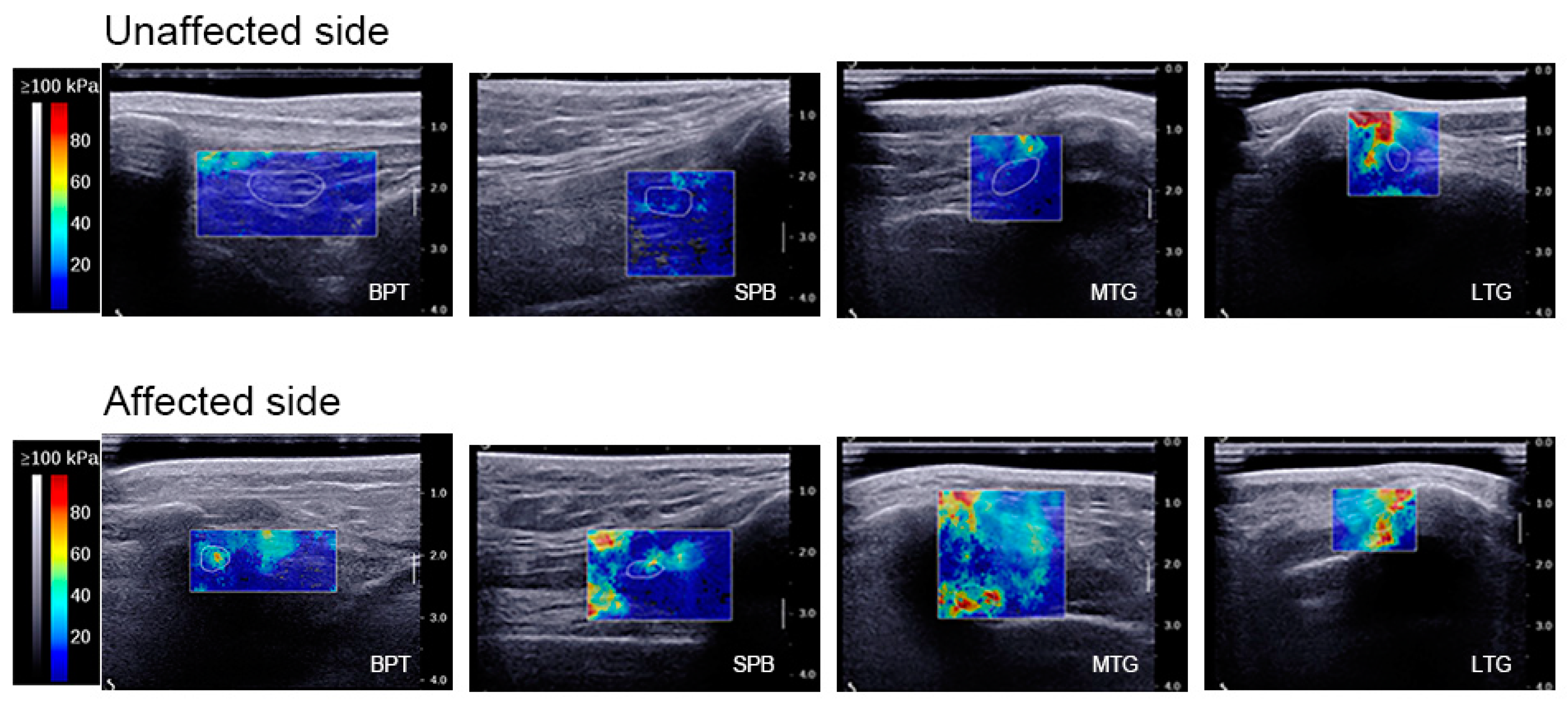 Bioengineering 11 00706 g002