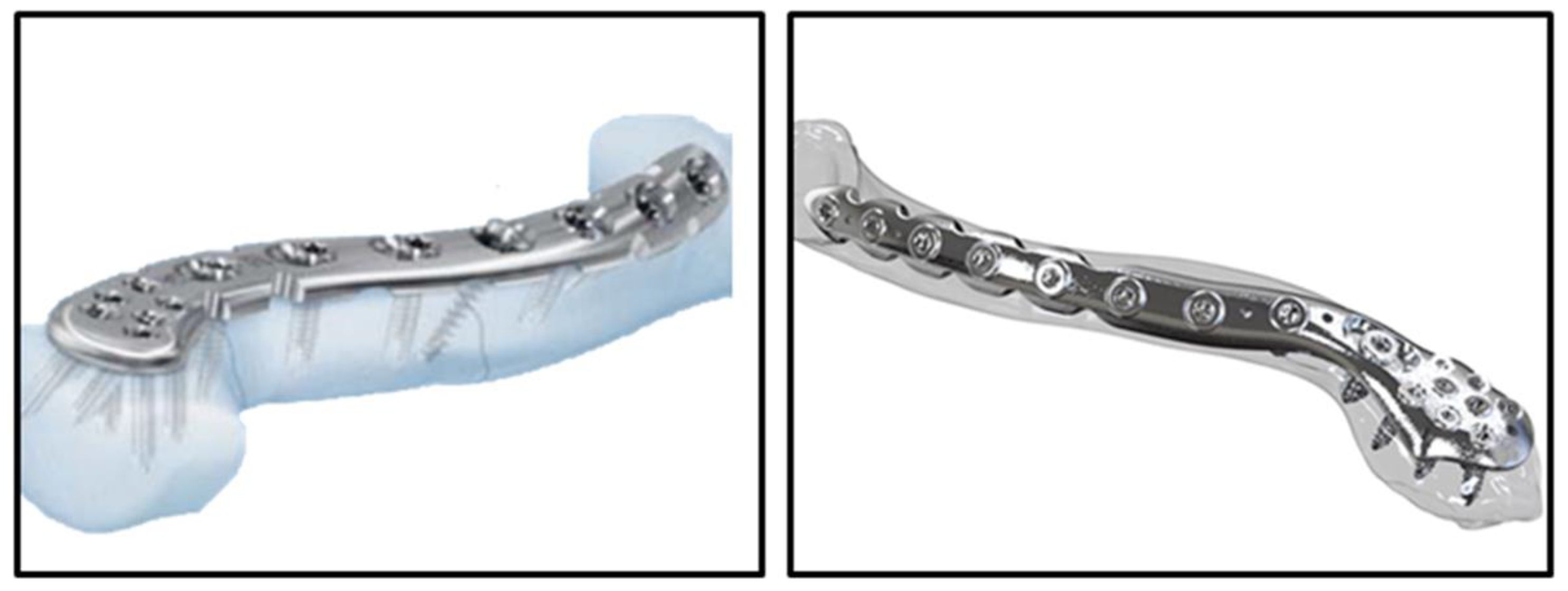 Bioengineering 11 00713 g001 Bioengineering 11 00713 g001