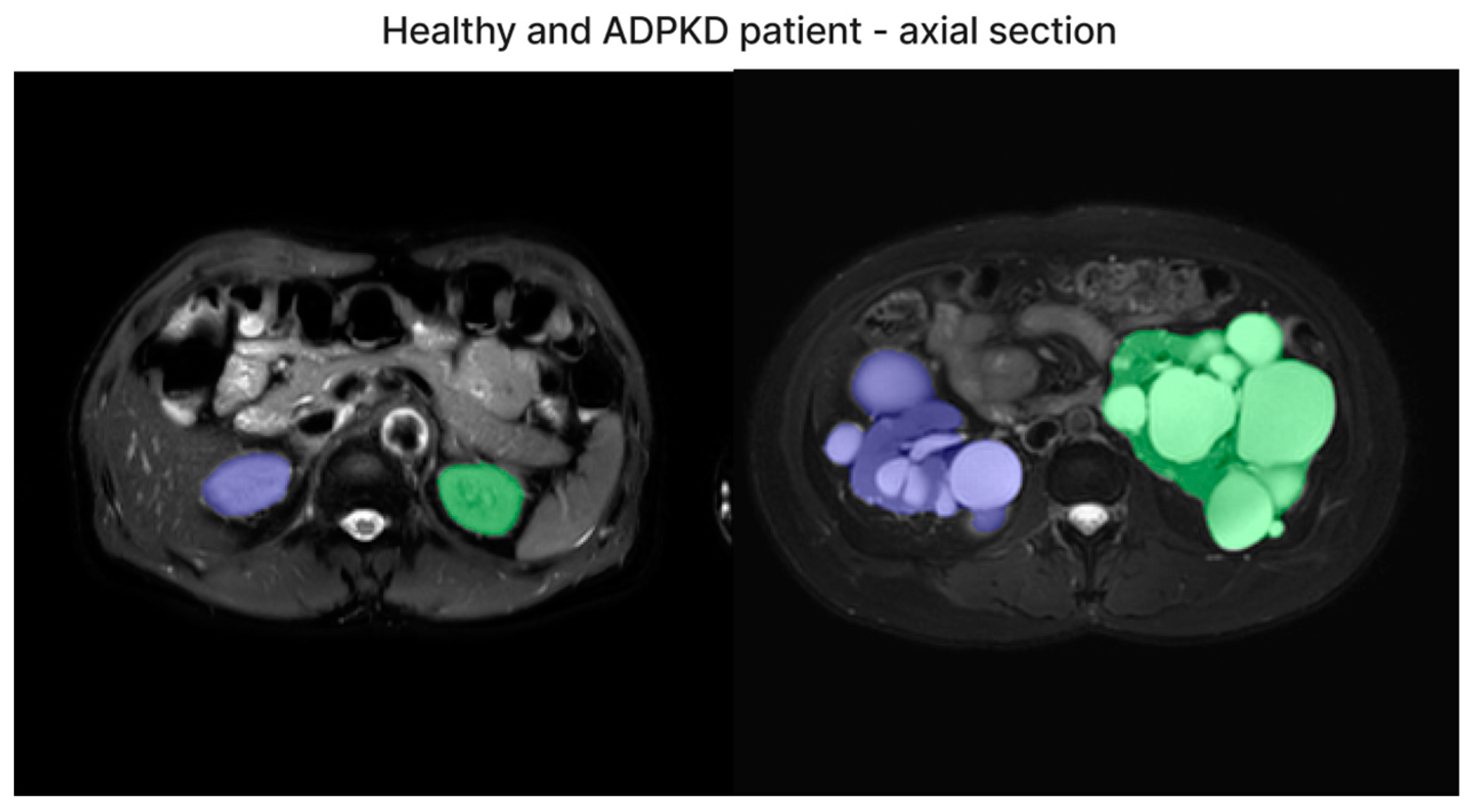 Bioengineering 11 00963 g006 Bioengineering 11 00963 g006
