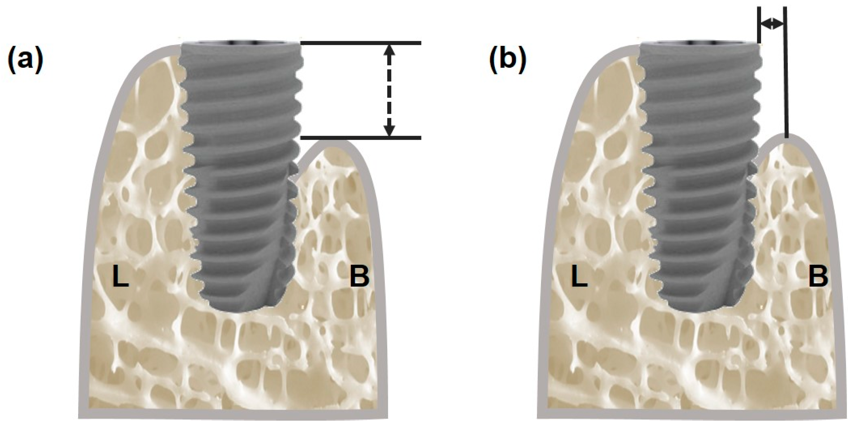 Bioengineering 11 00980 g003