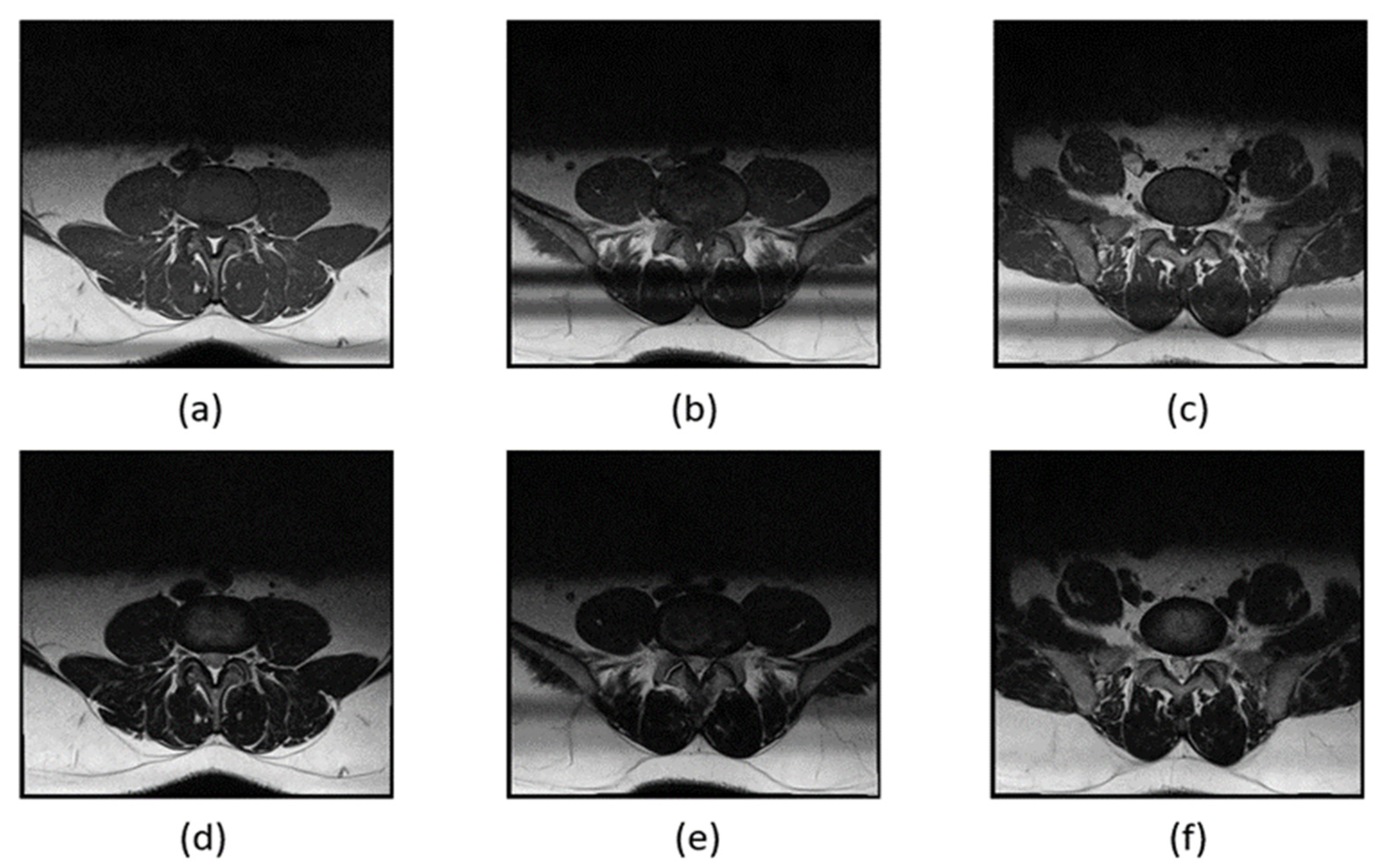 Bioengineering 11 00981 g008