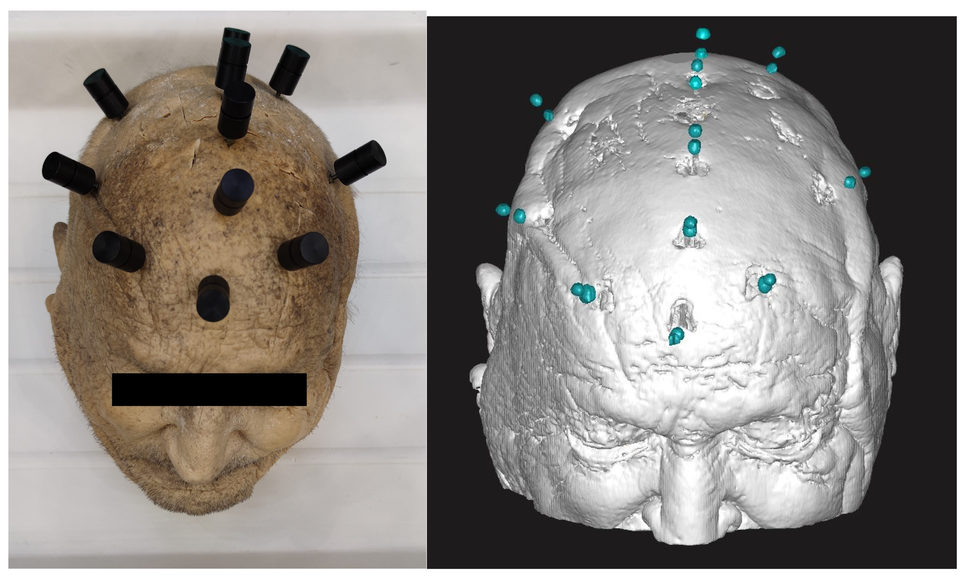 Bioengineering 11 01013 g001