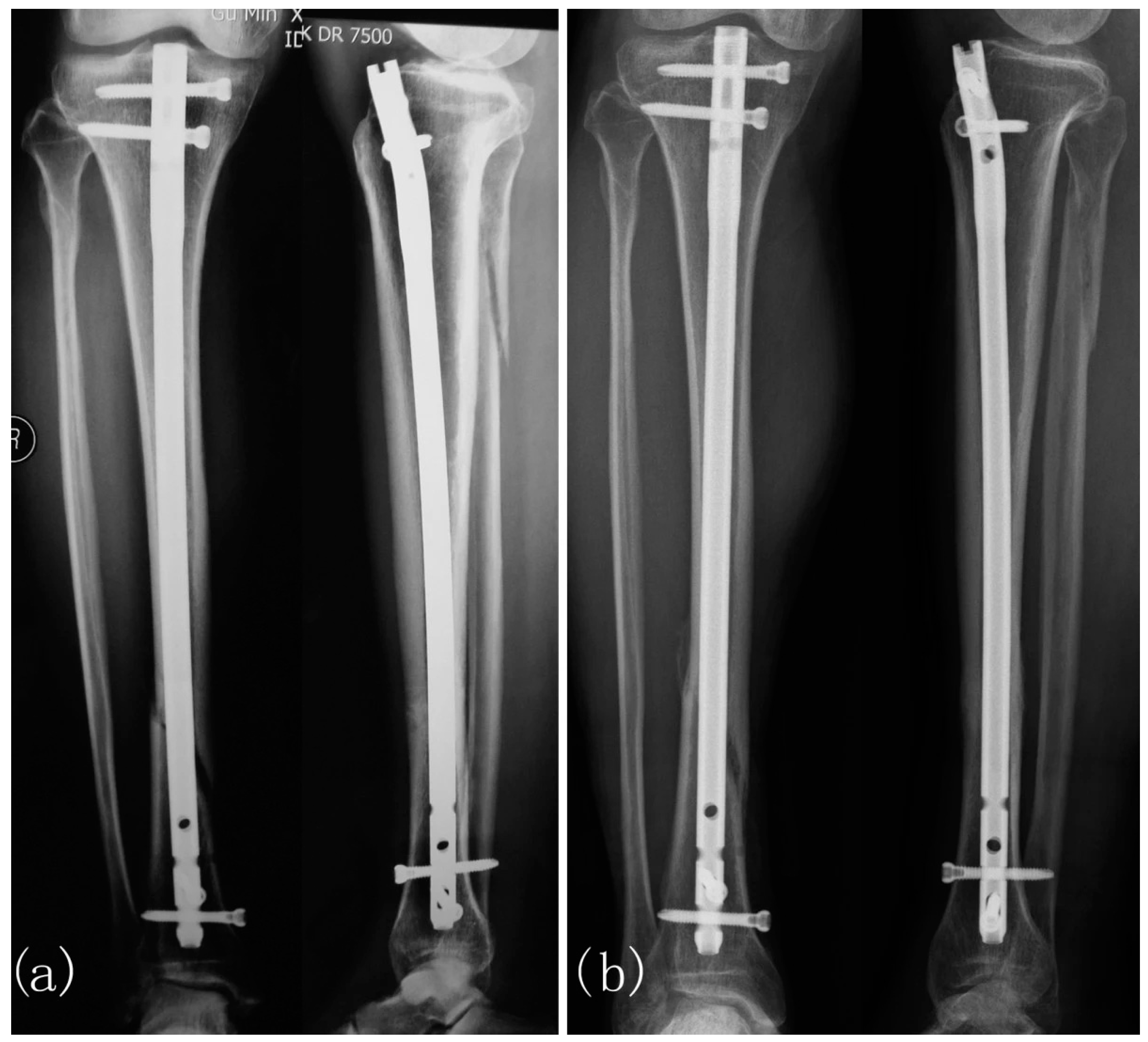 Bioengineering 11 01223 g006