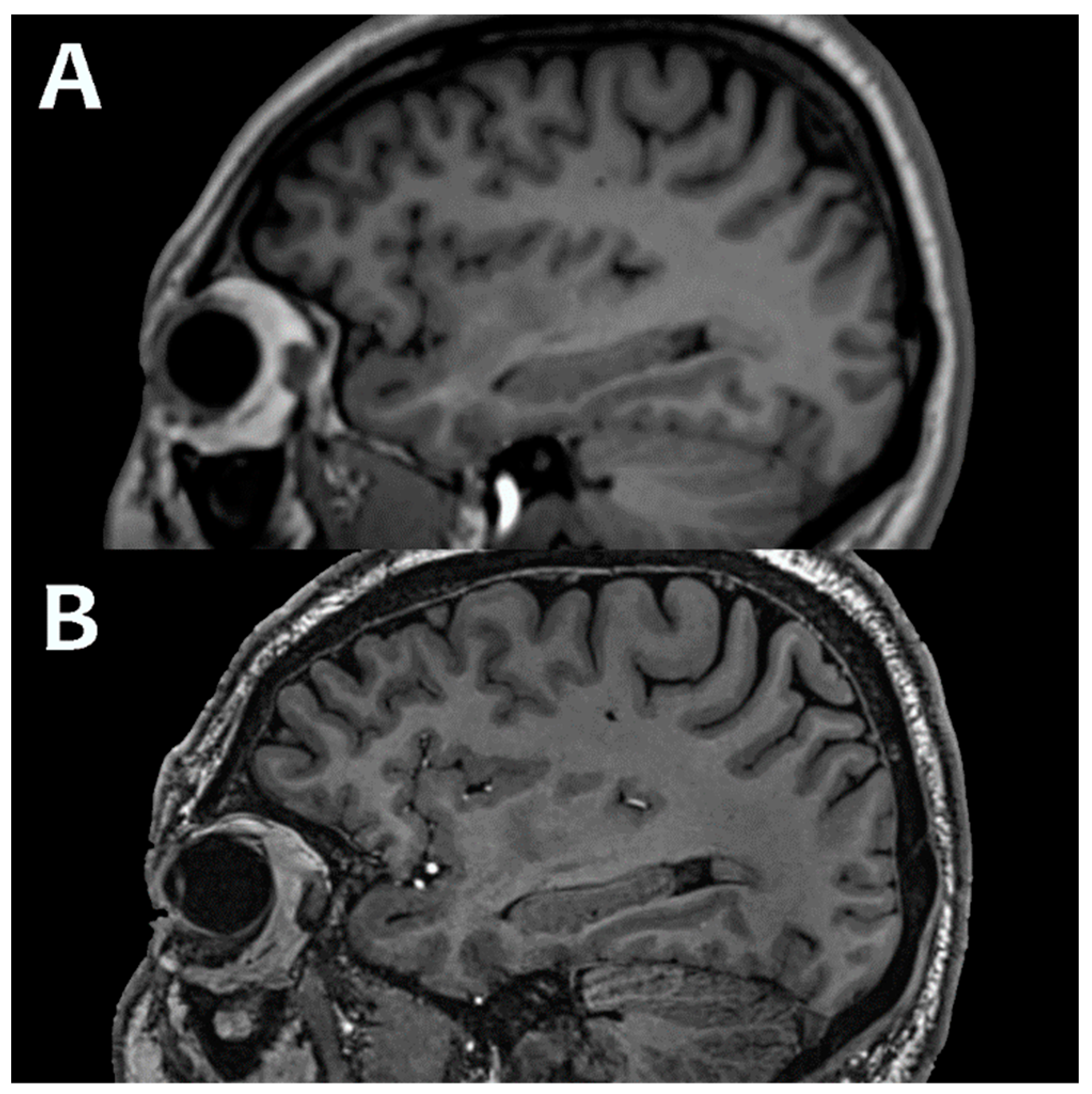 Bioengineering 11 01228 g001