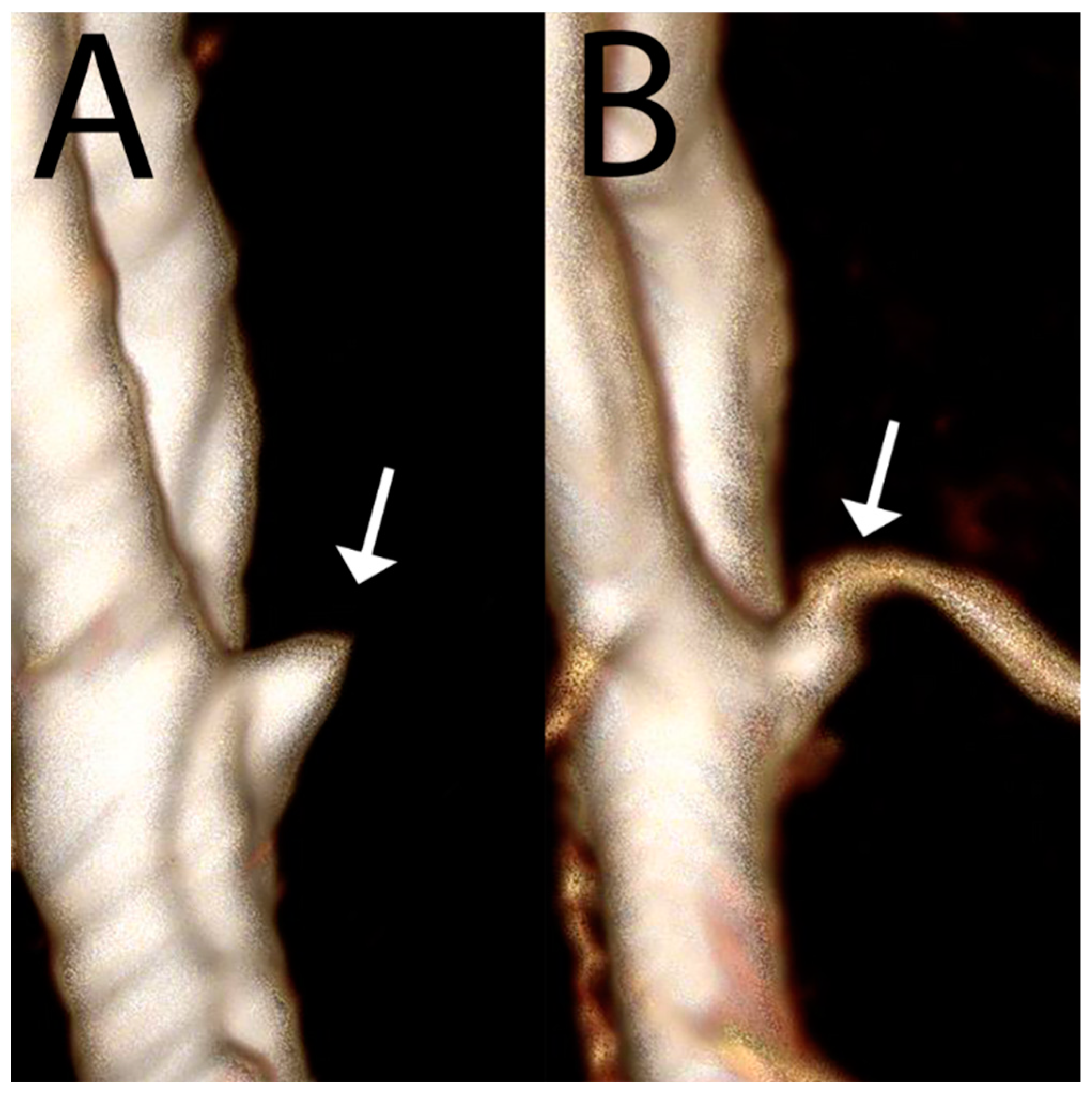 Bioengineering 11 01228 g004
