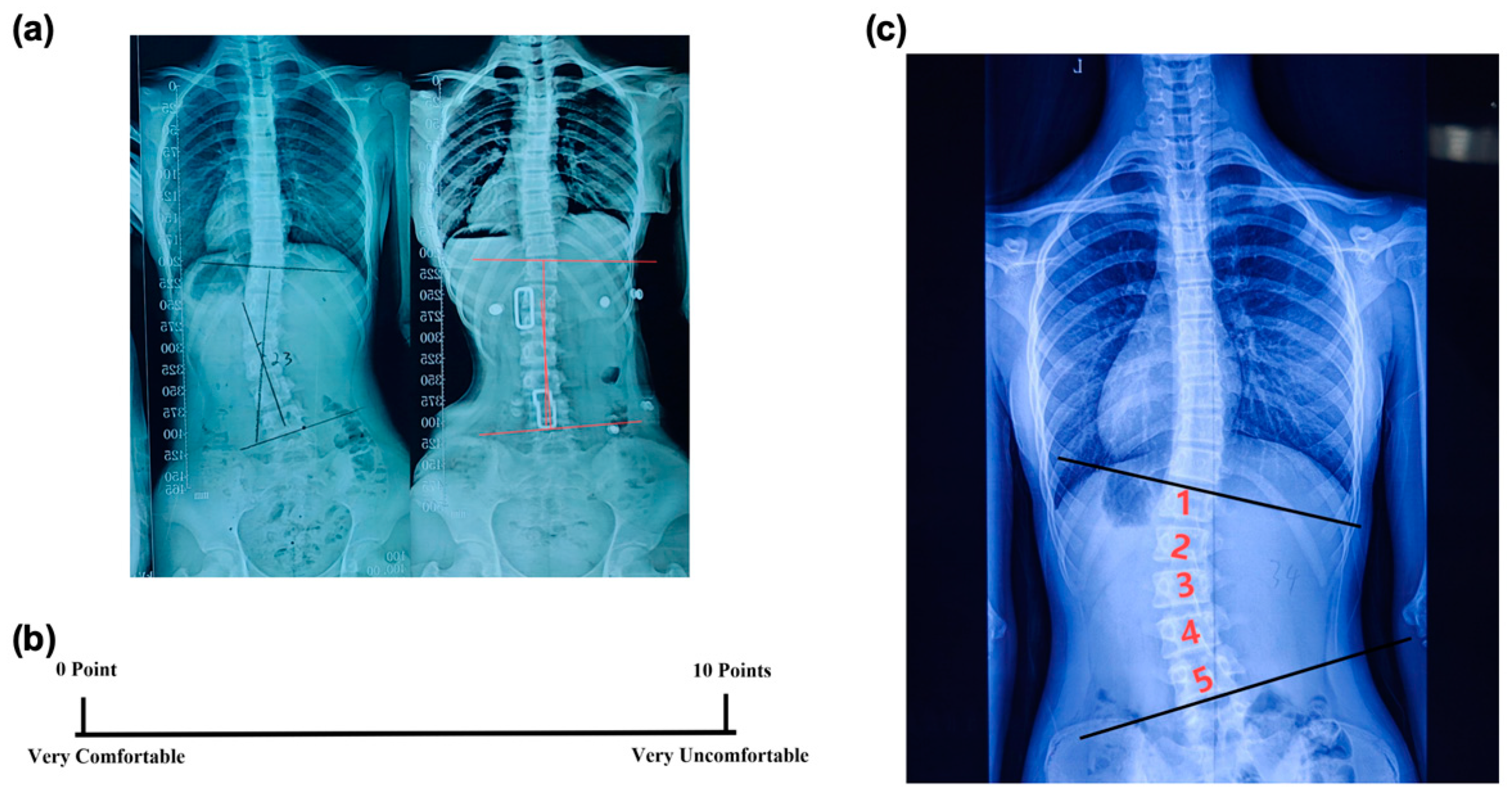 Bioengineering 11 01246 g003