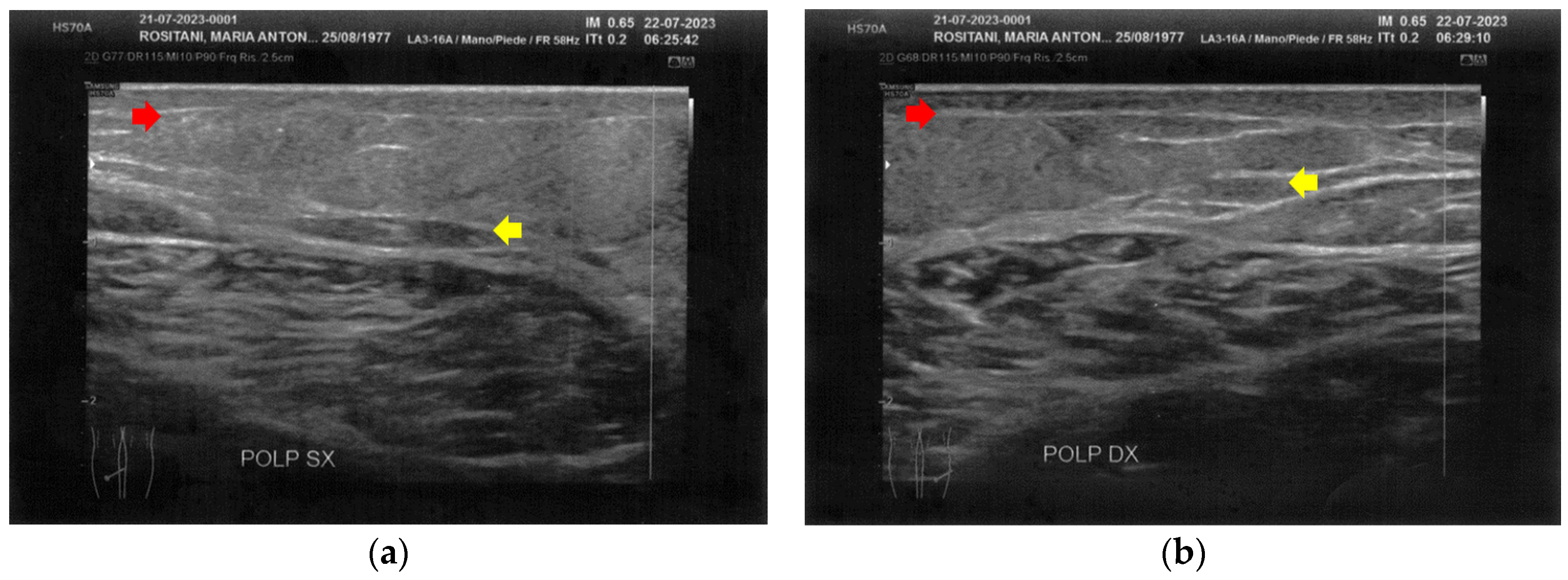 Bioengineering 12 00179 g008