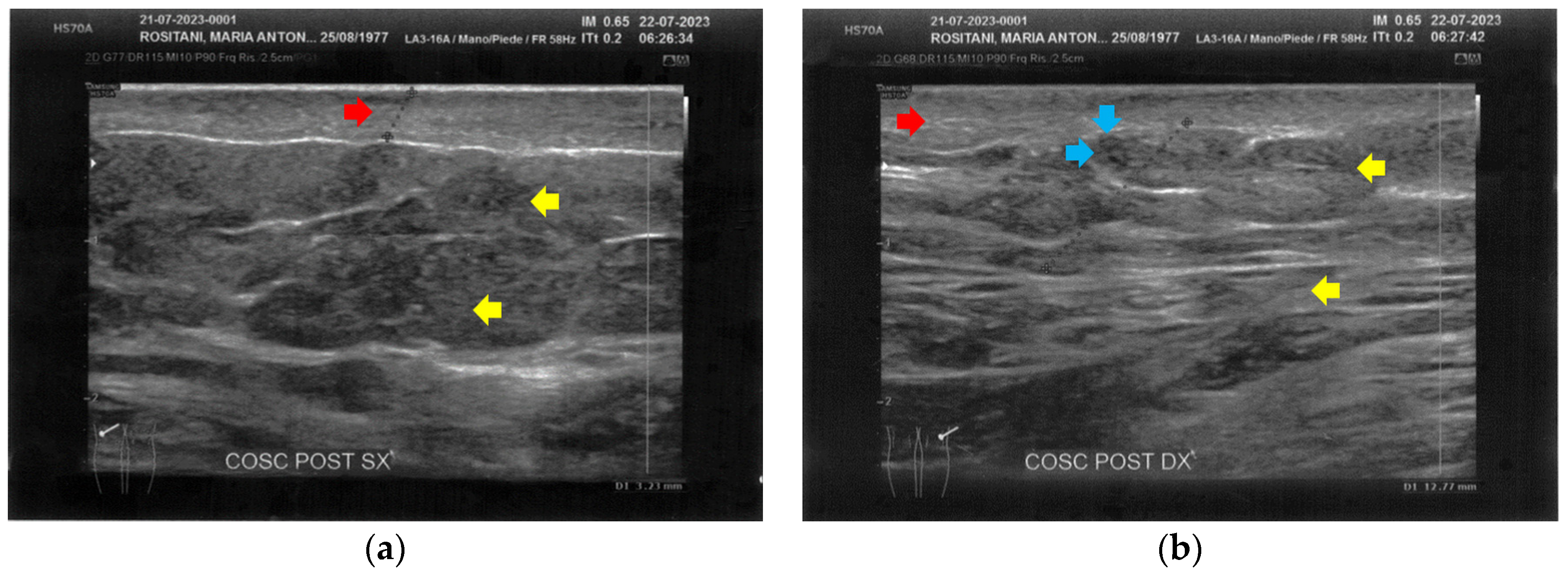Bioengineering 12 00179 g009