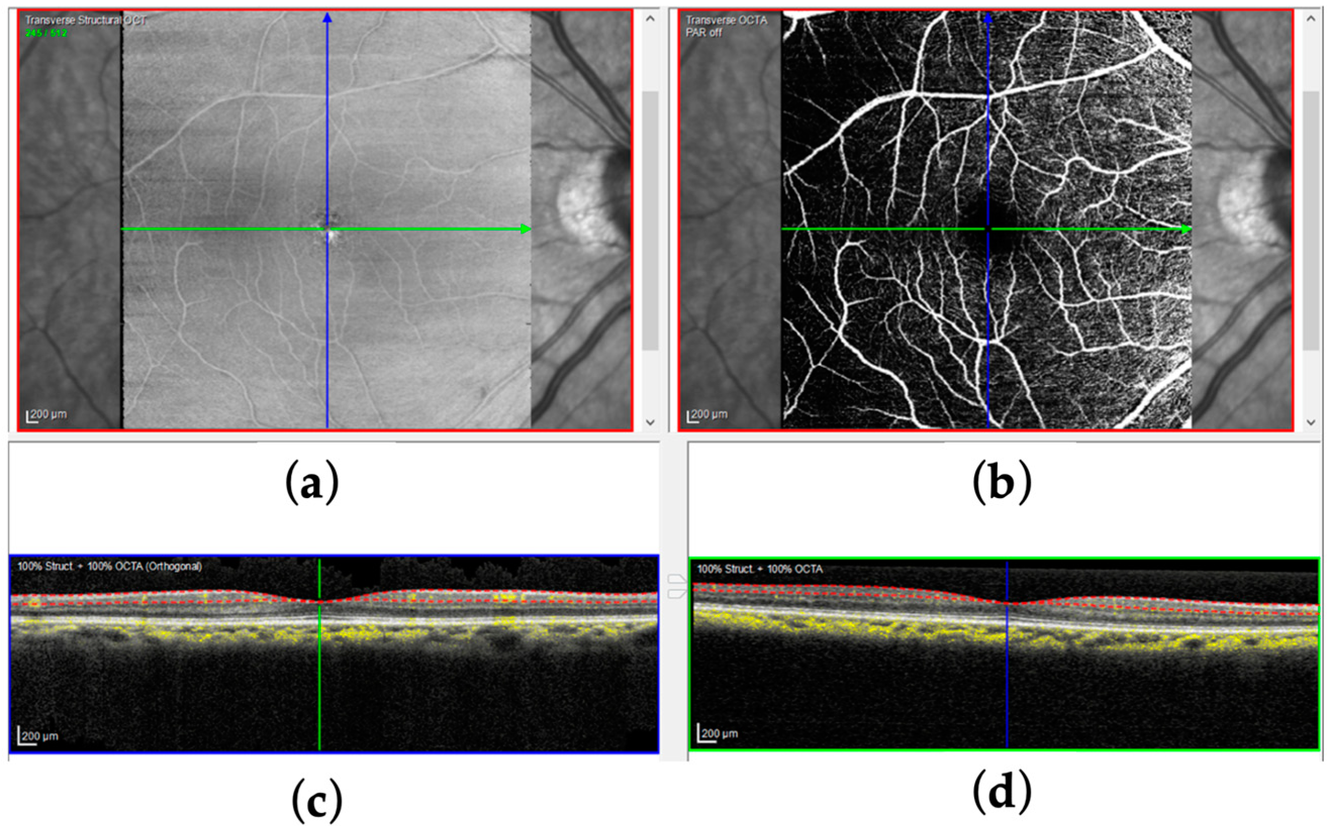 Bioengineering 12 00334 g001