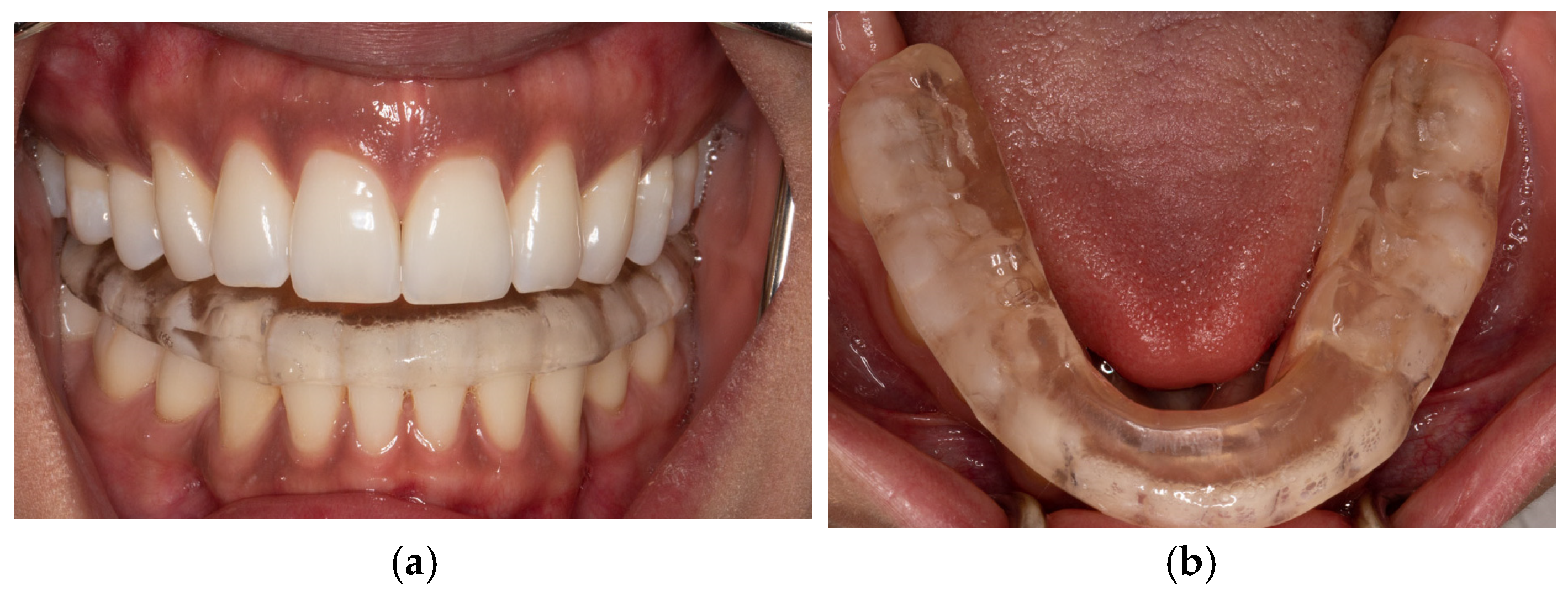 Bioengineering 12 00865 g006 Bioengineering 12 00865 g006