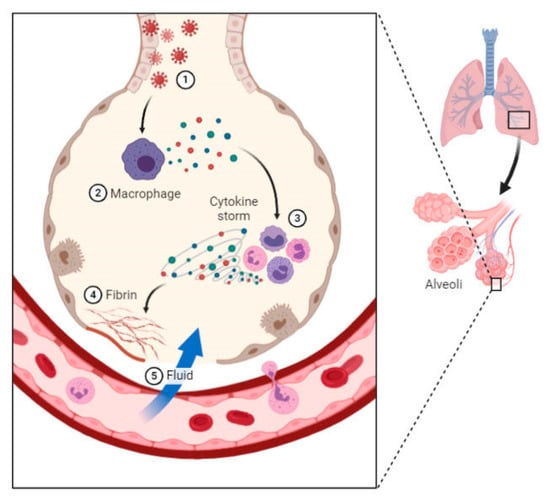 Biologics | Free Full-Text | Overview of COVID-19 Disease: Virology ...