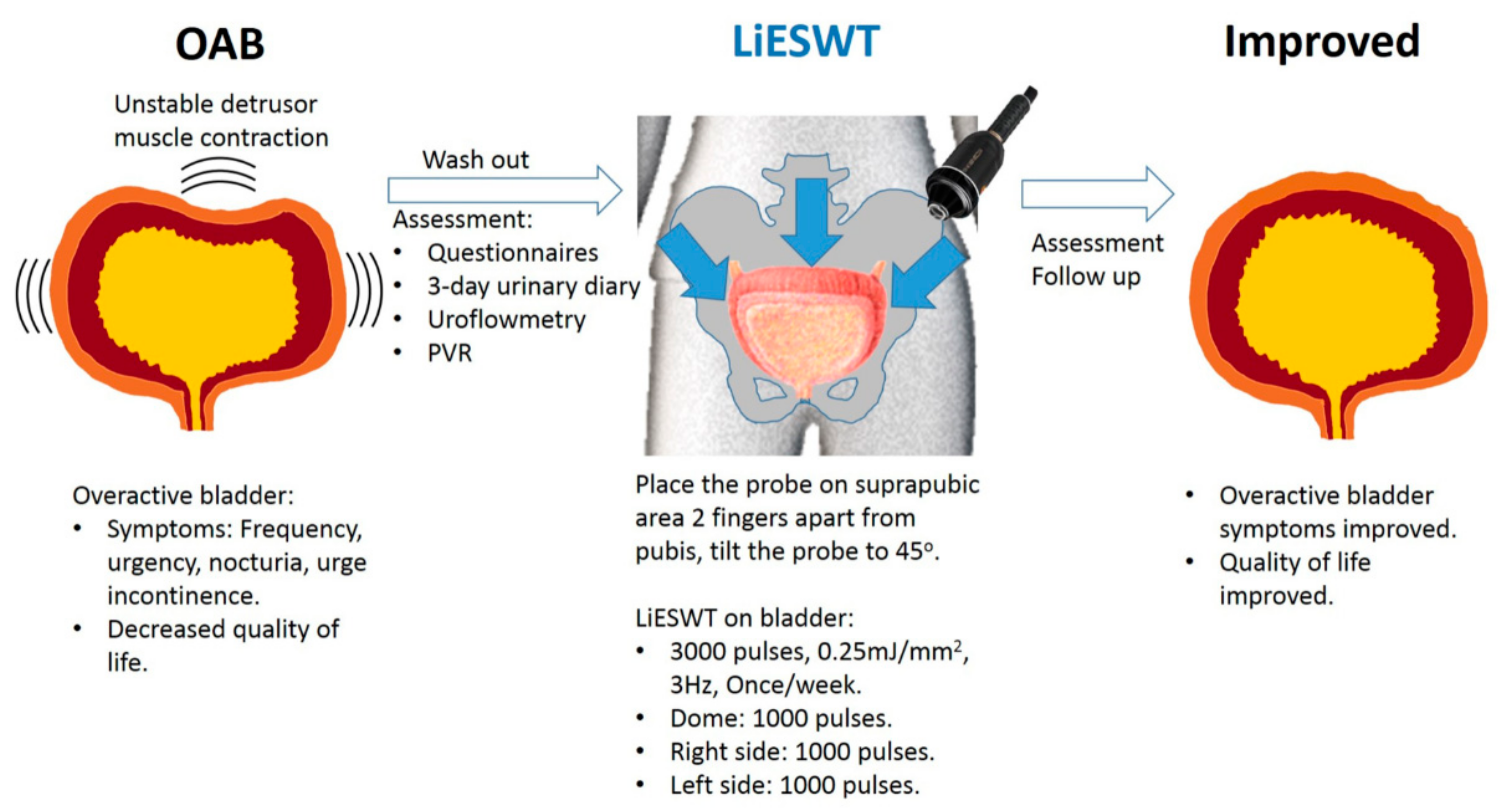 Guidelines for management of urinary incontinence - Nishizawa