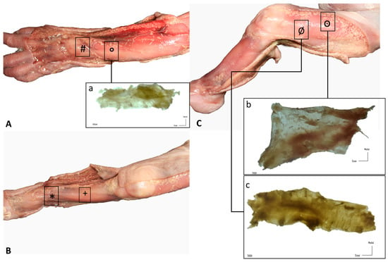 Gross Anatomy Lower Limb - Fascia Lata   