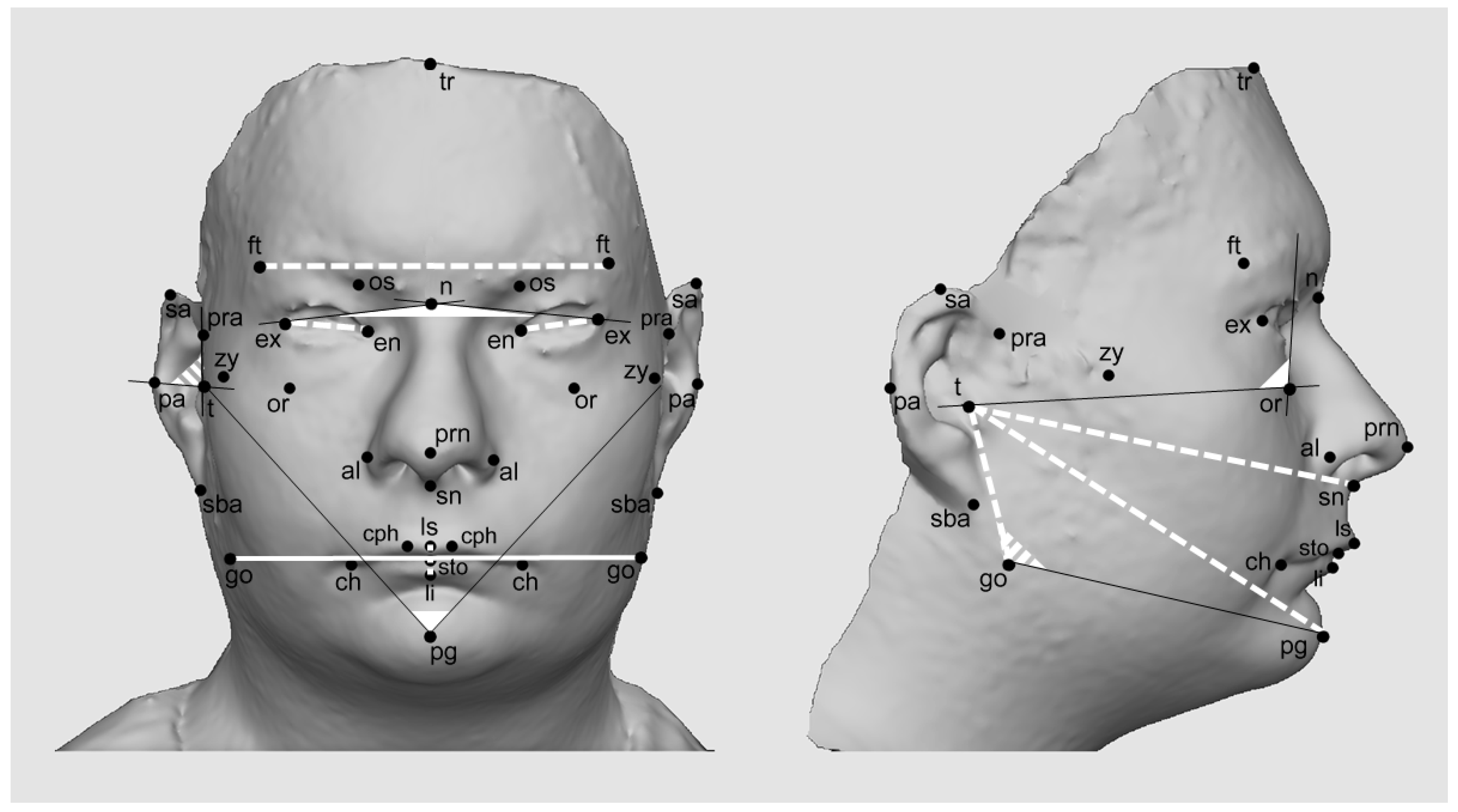 Total Face Height Measurement Tutorial Using Anthropometry Portable