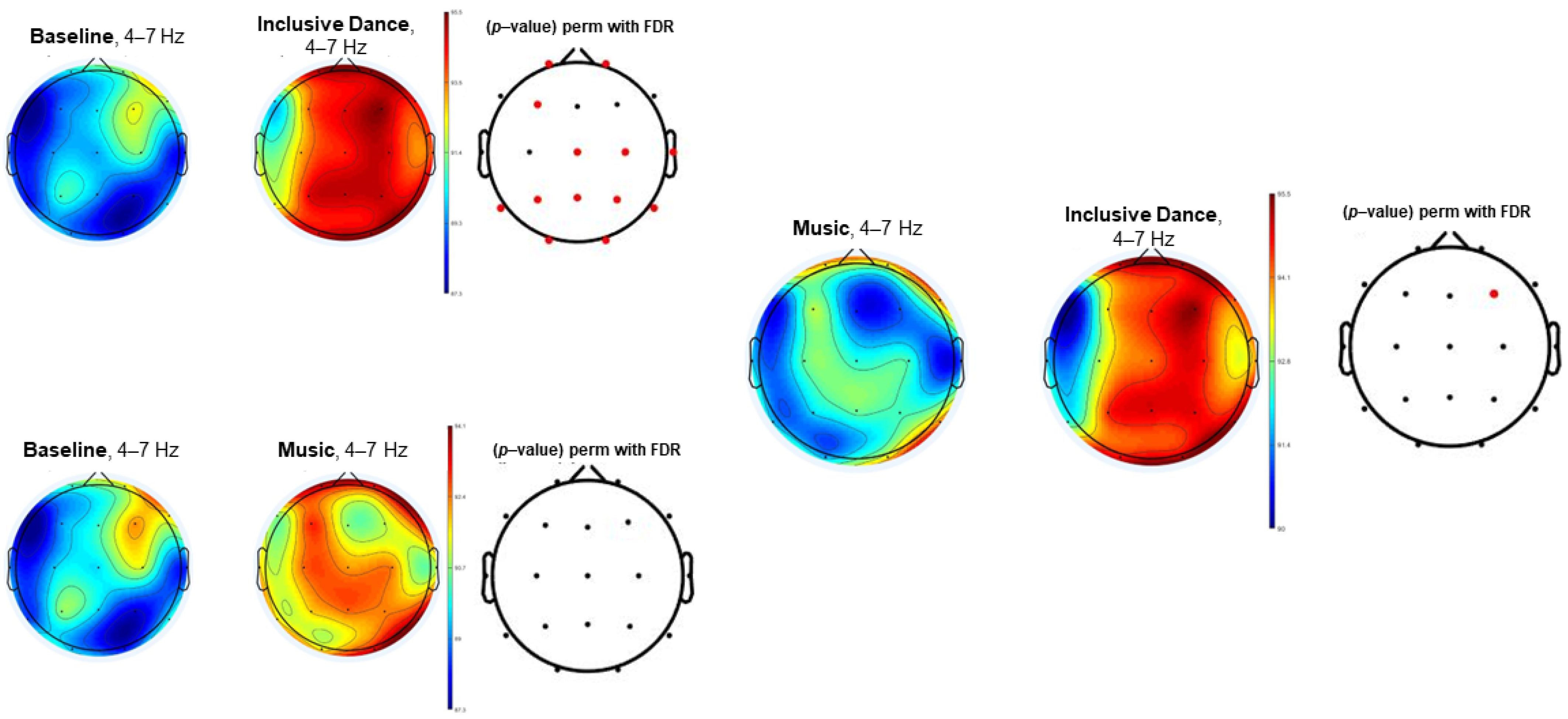 Channel spectra and map visualization of the beta band (13-30 Hz) of a