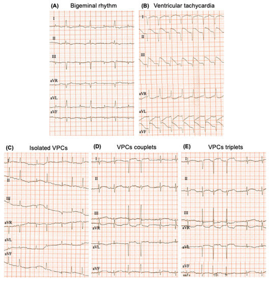 Biology Free Full Text Age And Sex Determine Electrocardiogram Parameters In The Octodon Degus 8827