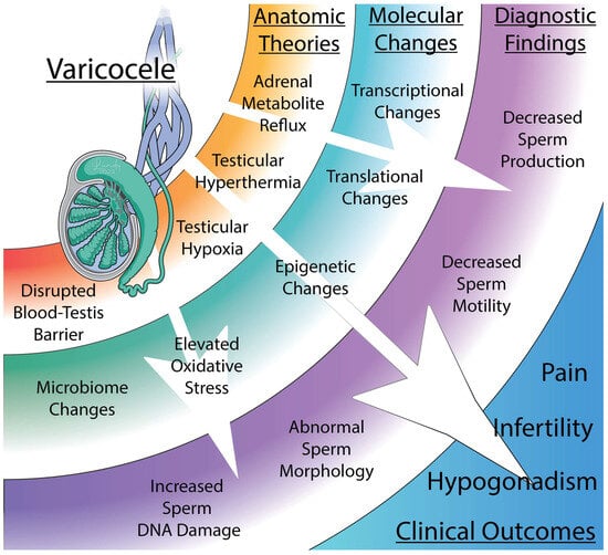 Varicocele: Risk Factors, Diagnosis and Treatment