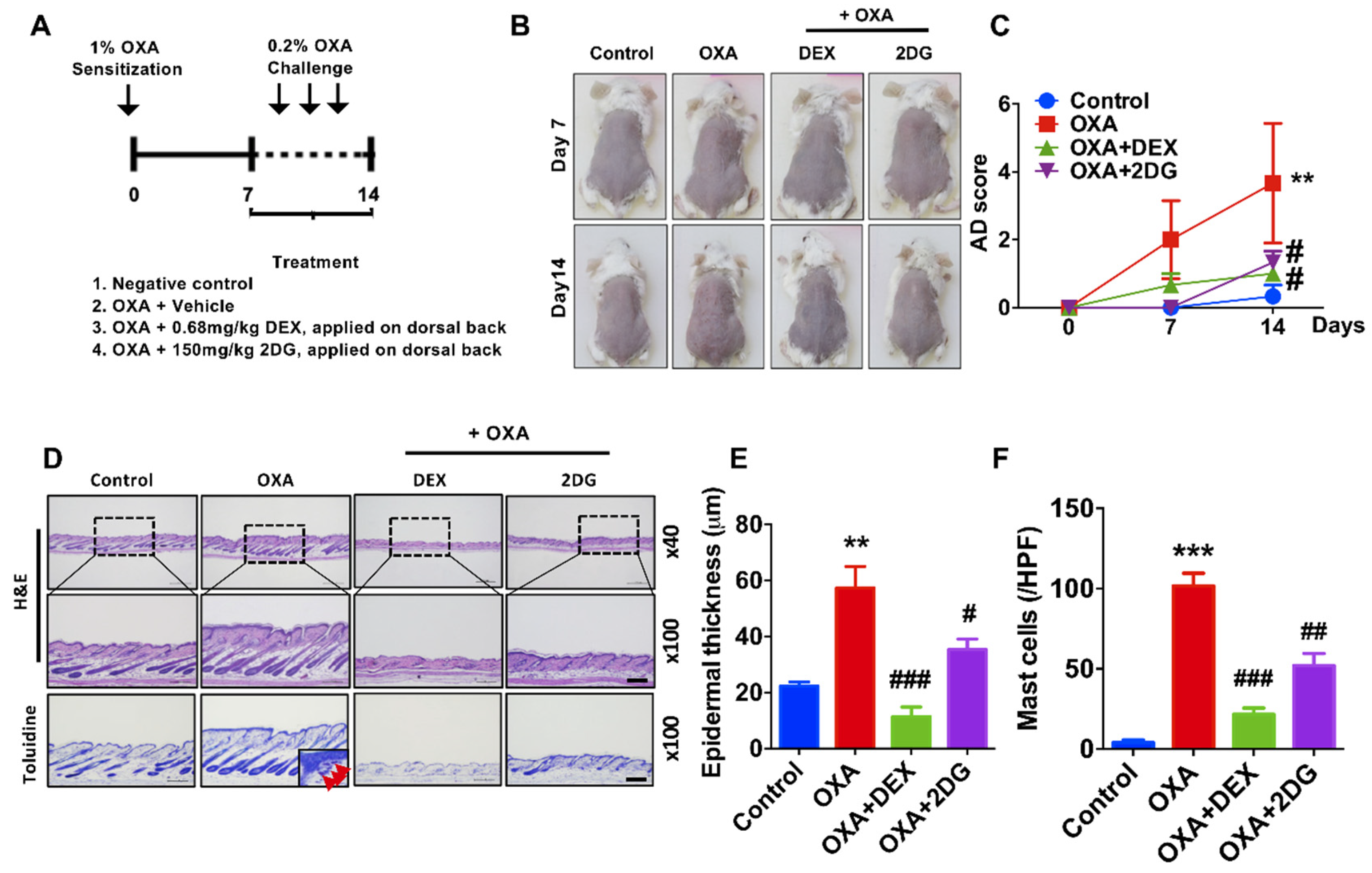 Biomedicines Free Full Text 2 Deoxy D Glucose Ameliorates Animal Models Of Dermatitis Html