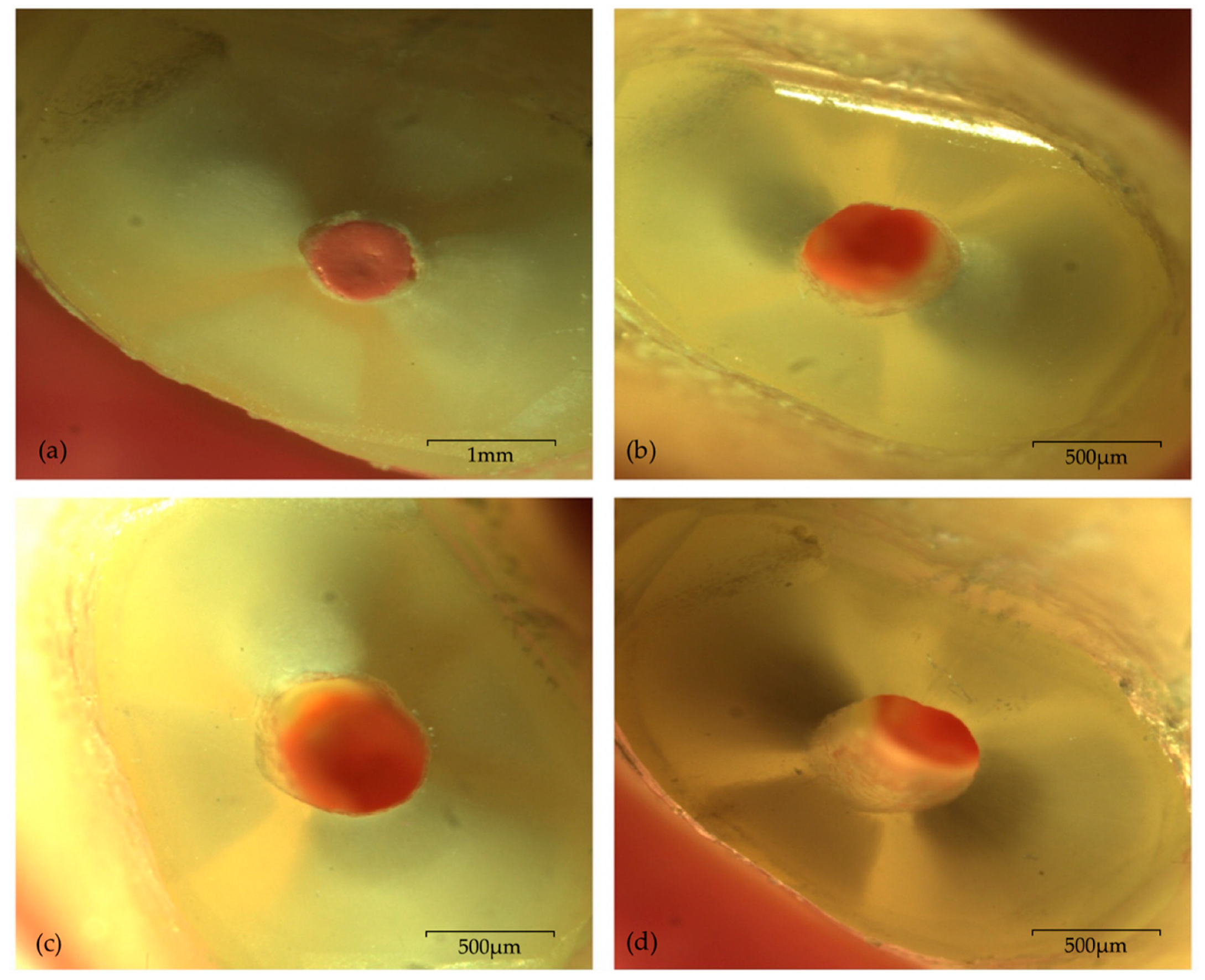 Biomedicines Free Full Text Evaluation Of Root End Preparation With Two Different Endodontic Microsurgery Ultrasonic Tips Html