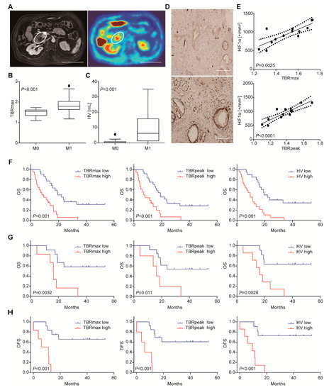 Interaction of IL-38 and DSTN in HEK293T cells. Association of IL-38