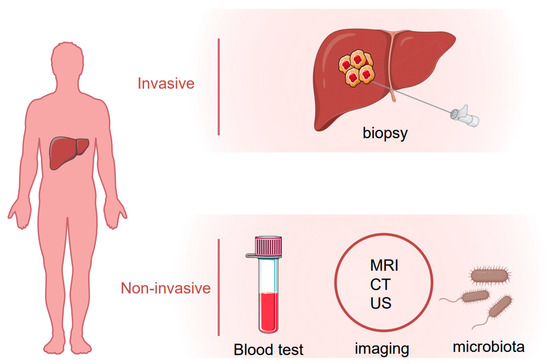 Biomedicines Free Full Text Biomarkers In Hepatocellular Carcinoma