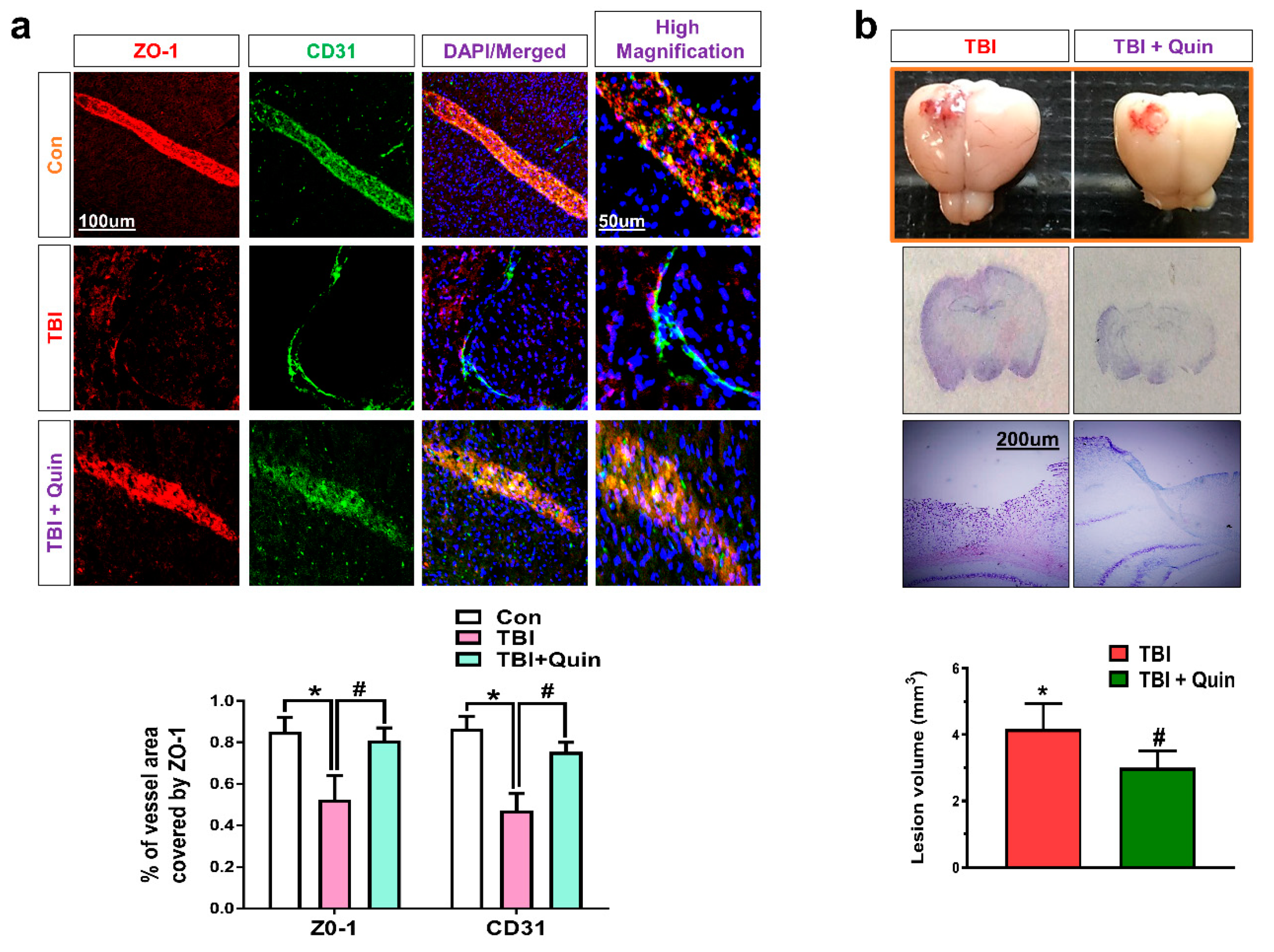 Biomedicines 09 00047 g005 Biomedicines 09 00047 g005