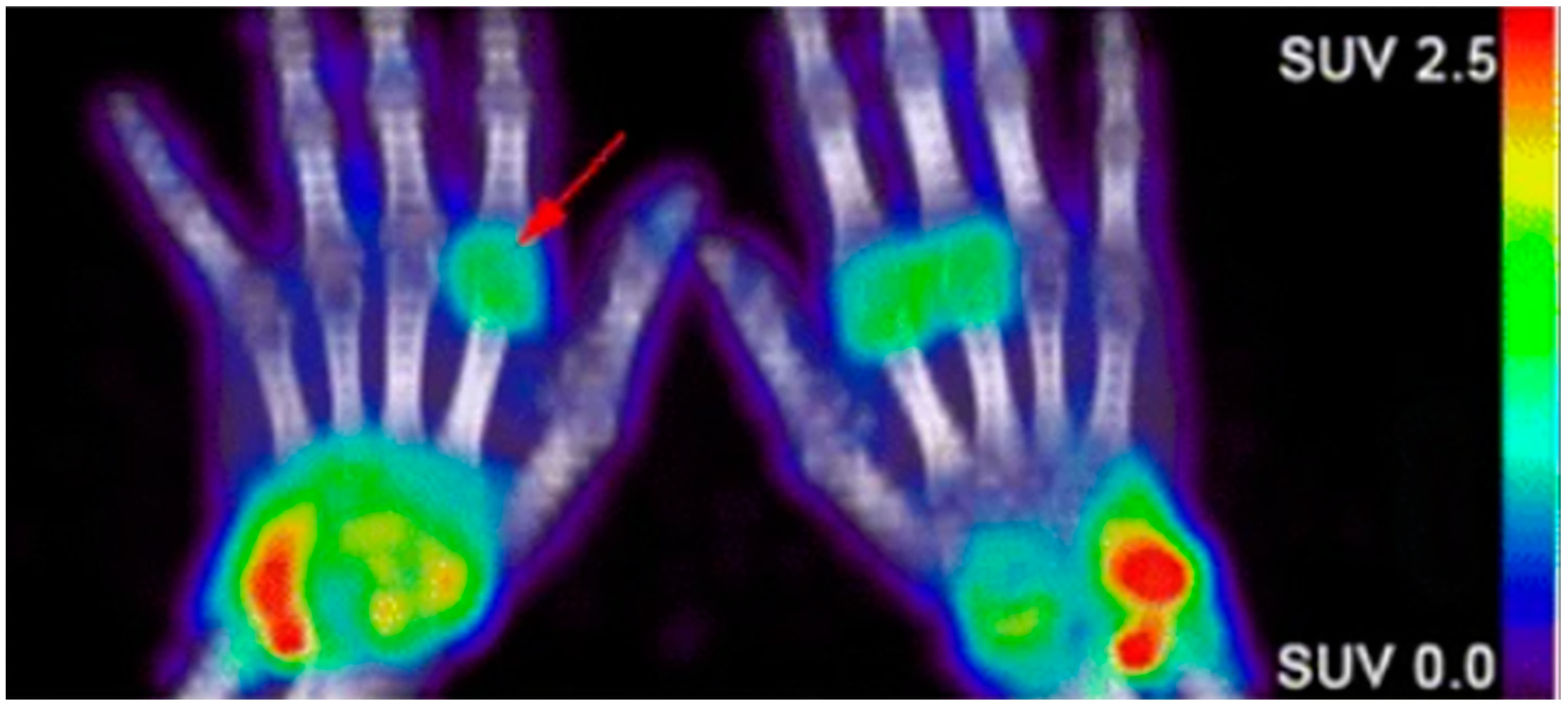 Biomedicines 09 00152 g002 Biomedicines 09 00152 g002