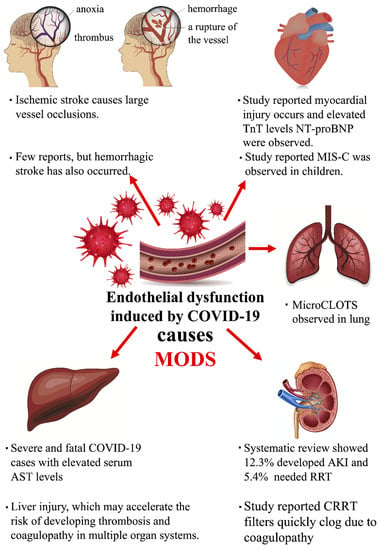 Biomedicines Free Full Text Severe Covid 19 Infection Associated With Endothelial Dysfunction Induces Multiple Organ Dysfunction A Review Of Therapeutic Interventions Html