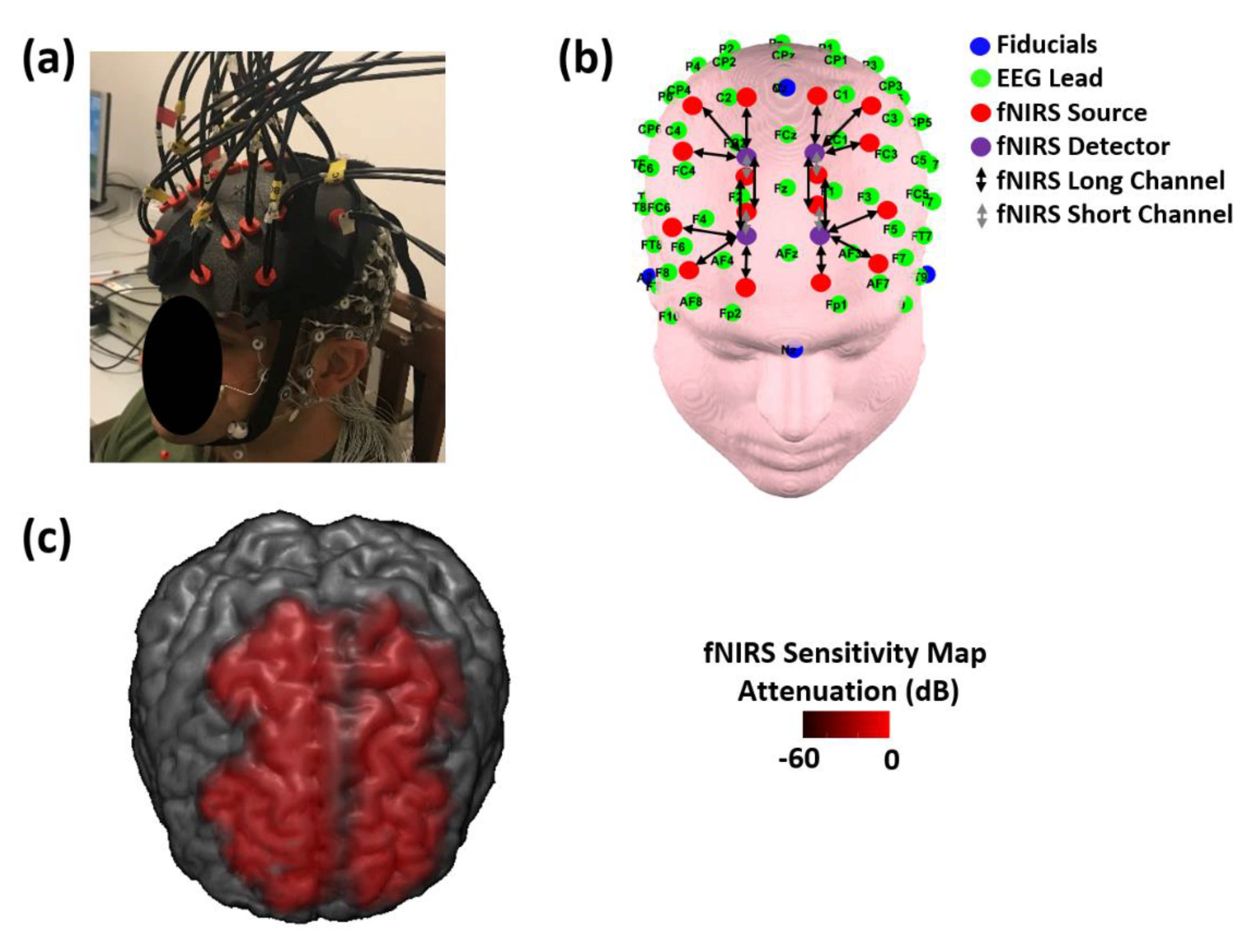 Biomedicines | Free Full-Text | Evidence of Neurovascular Un-Coupling in  Mild Alzheimer's Disease through Multimodal EEG-fNIRS and Multivariate  Analysis of Resting-State Data