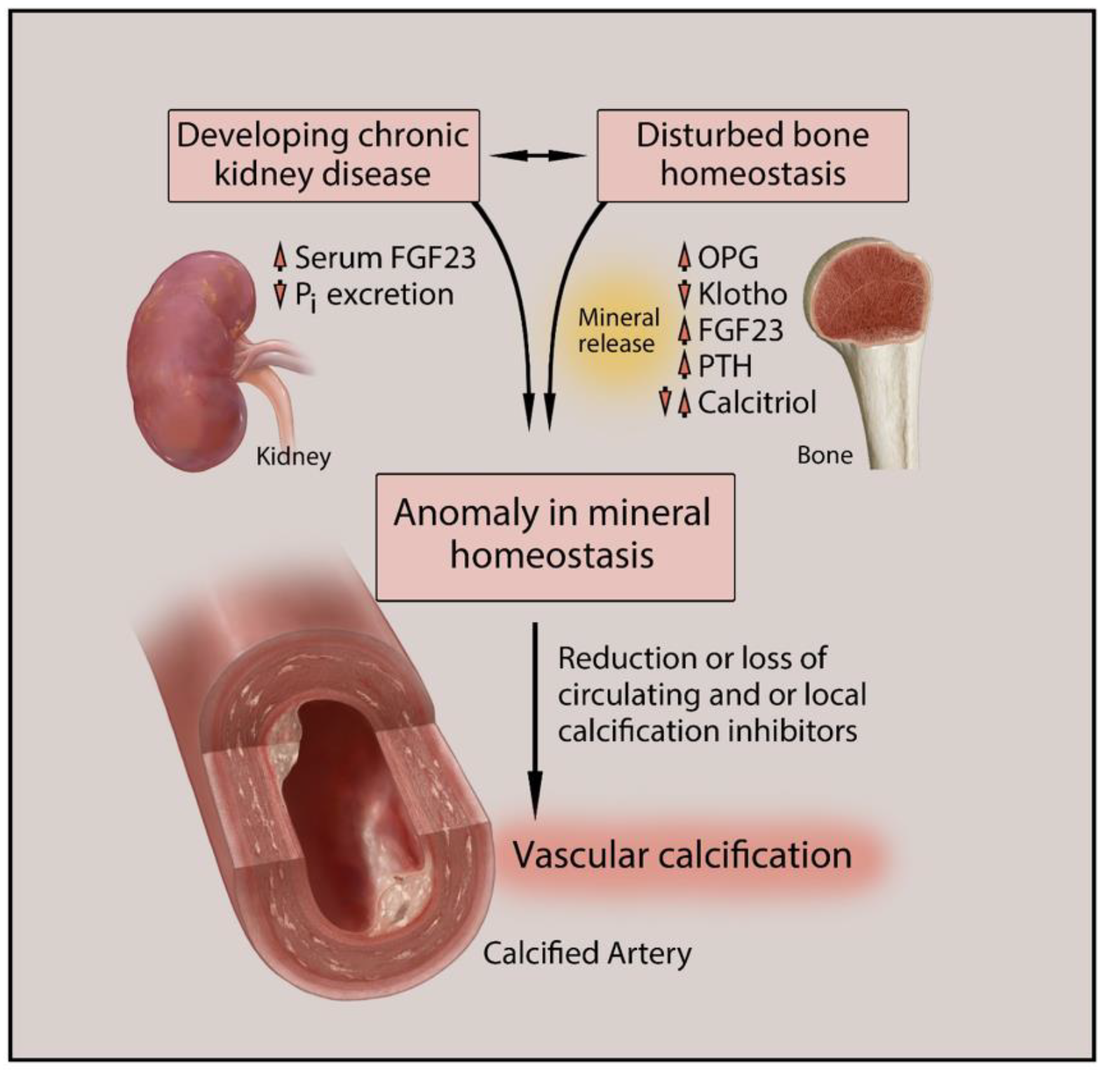 Biomedicines | Free Full-Text | Vascular Calcification in Chronic Kidney  Disease: Diversity in the Vessel Wall | HTML