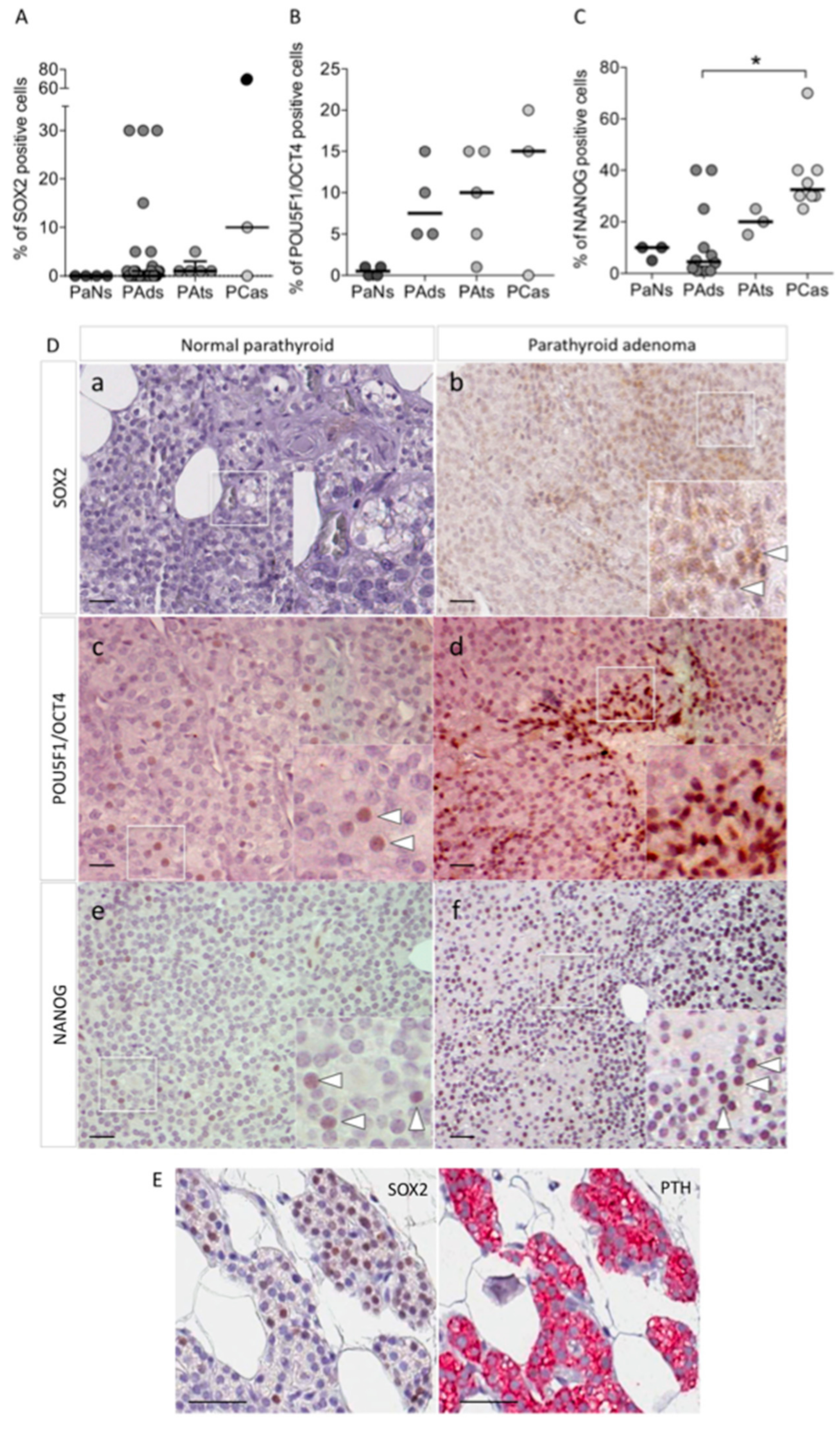 Critical POU domain residues confer Oct4 uniqueness in somatic cell  reprogramming