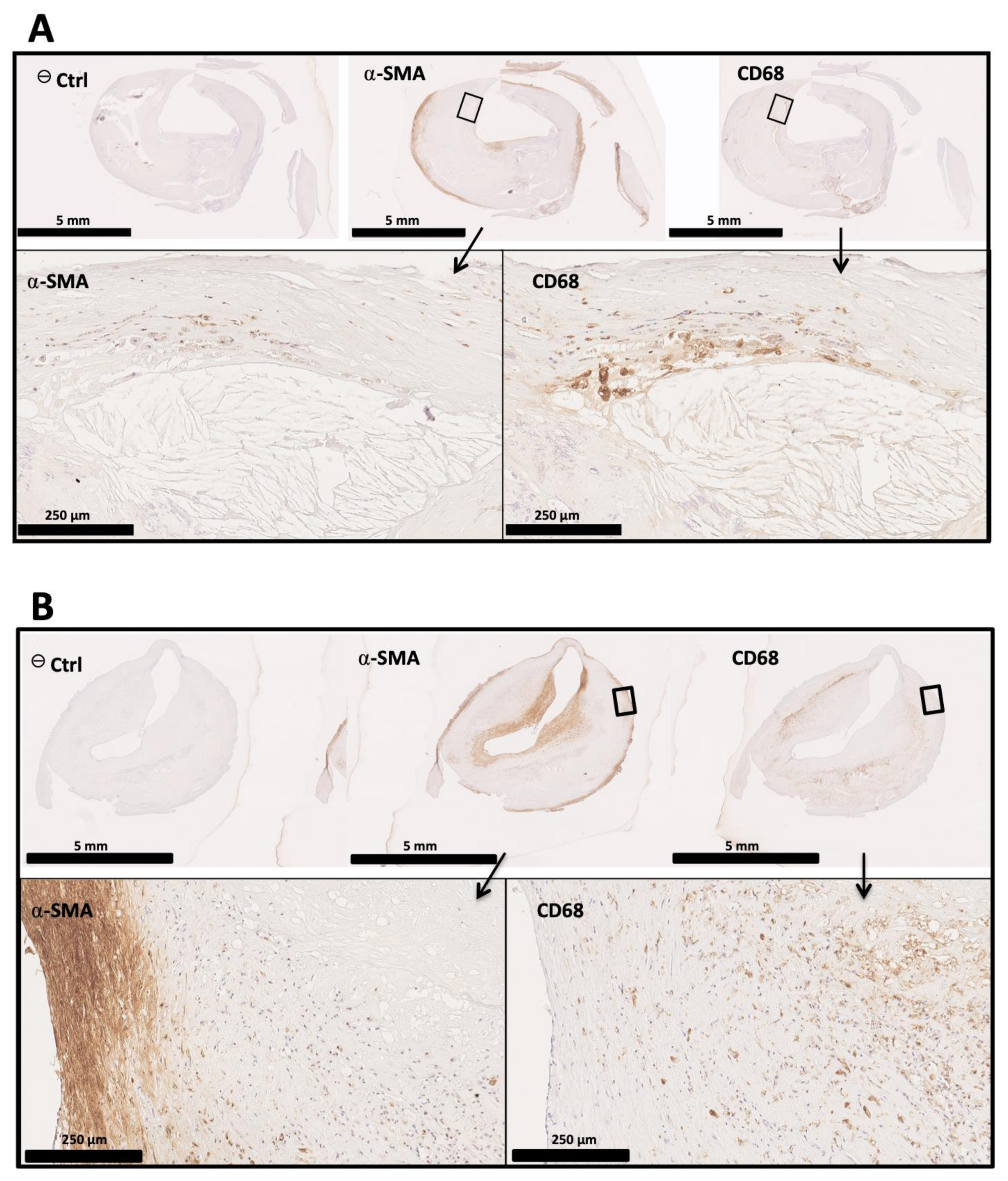 Biomedicines Free Full Text Macrophages In Atherosclerosis First Or Second Row Players Html