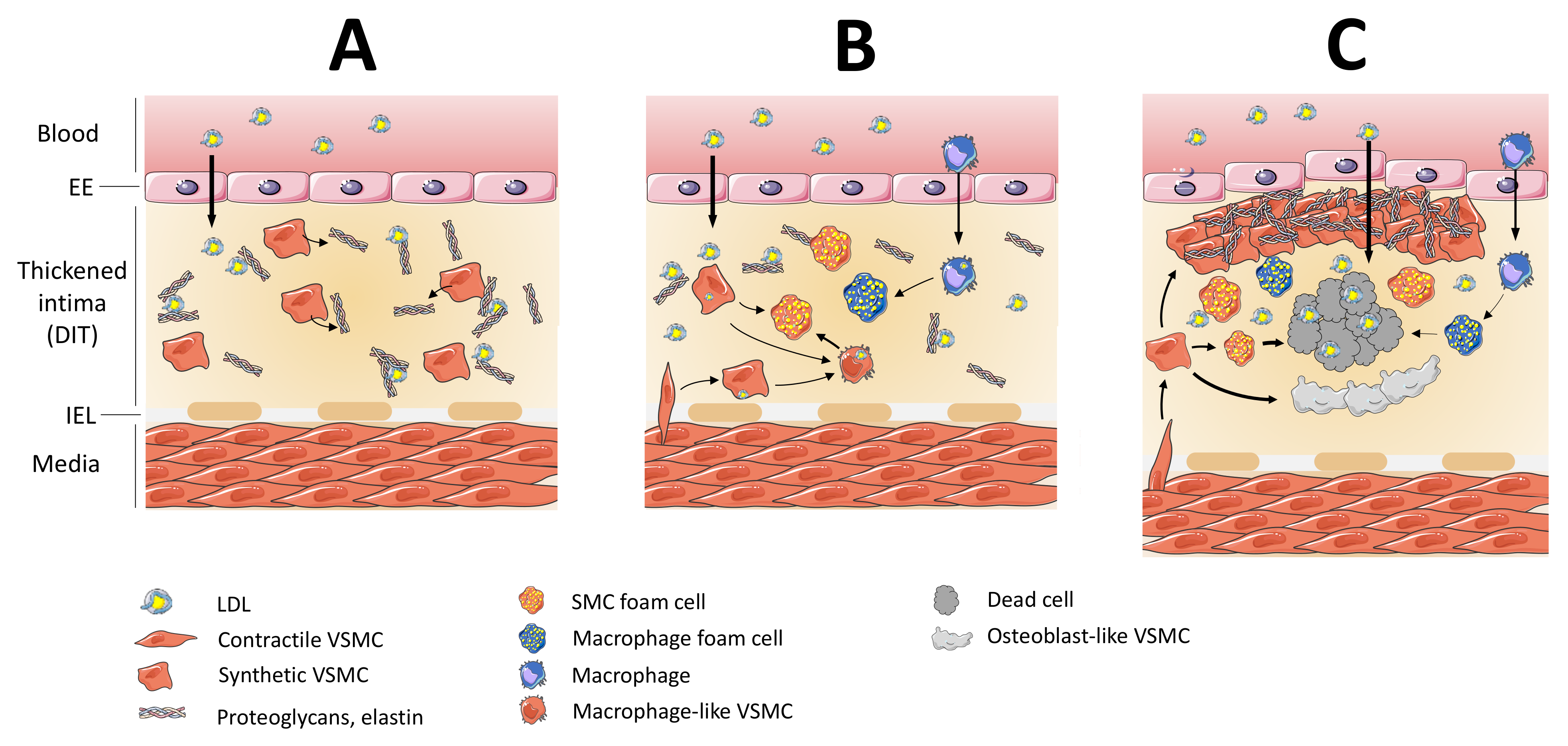 Biomedicines Free Full Text Macrophages In Atherosclerosis First Or Second Row Players Html