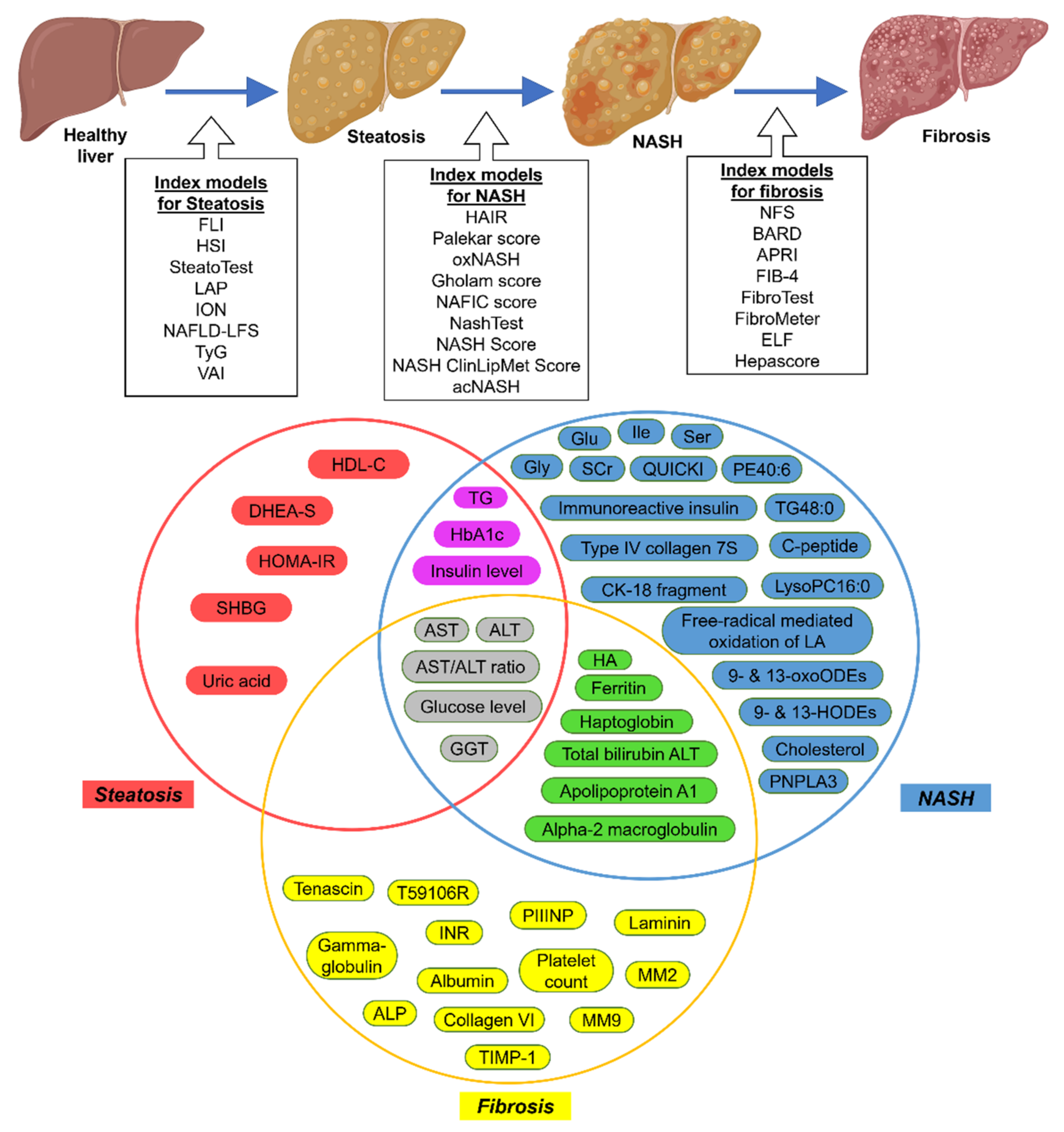 Biomedicines | Free Full-Text | Nonalcoholic Fatty Liver Disease (NAFLD):  Pathogenesis and Noninvasive Diagnosis
