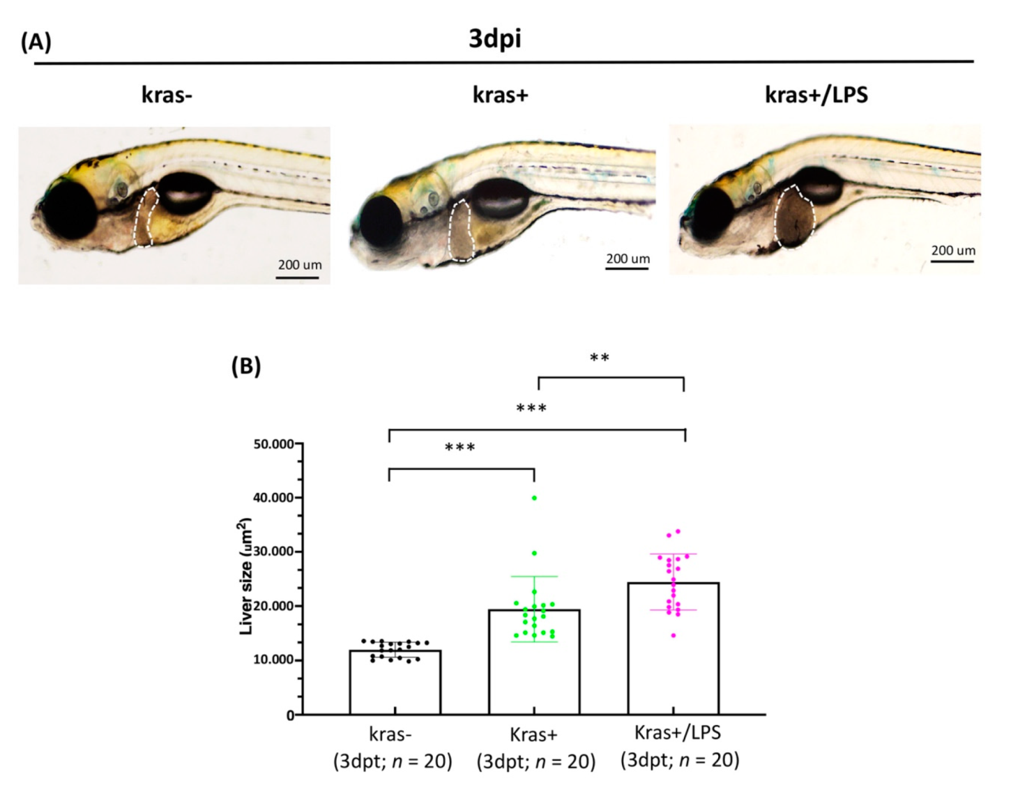 Biomedicines 10 00095 g005