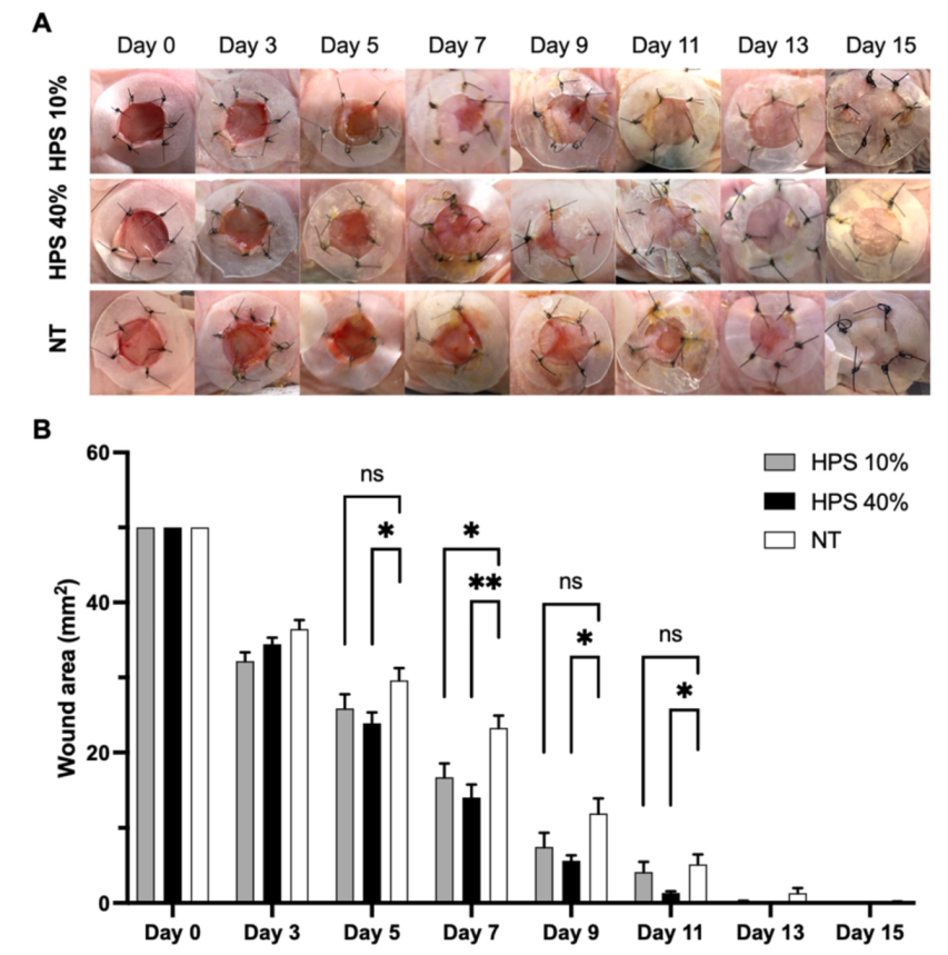 Biomedicines | Free Full-Text | Hypoxia Preconditioned Serum (HPS)-Hydrogel  Can Accelerate Dermal Wound Healing in Mice&mdash;An In Vivo Pilot Study
