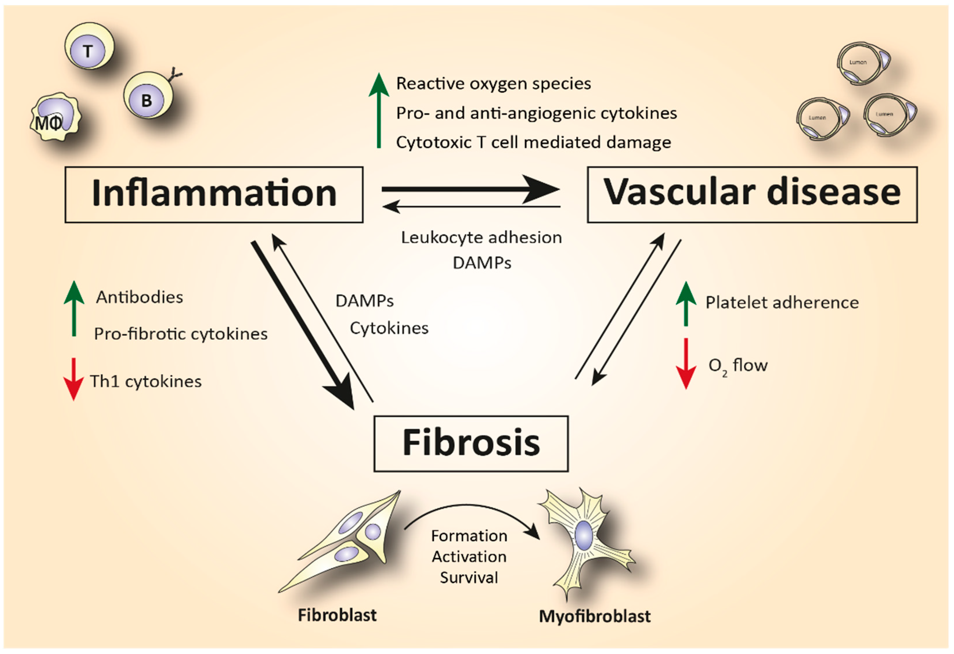 Biomedicines | Free Full-Text | Therapeutic Options for Systemic Sclerosis:  Current and Future Perspectives in Tackling Immune-Mediated Fibrosis | HTML