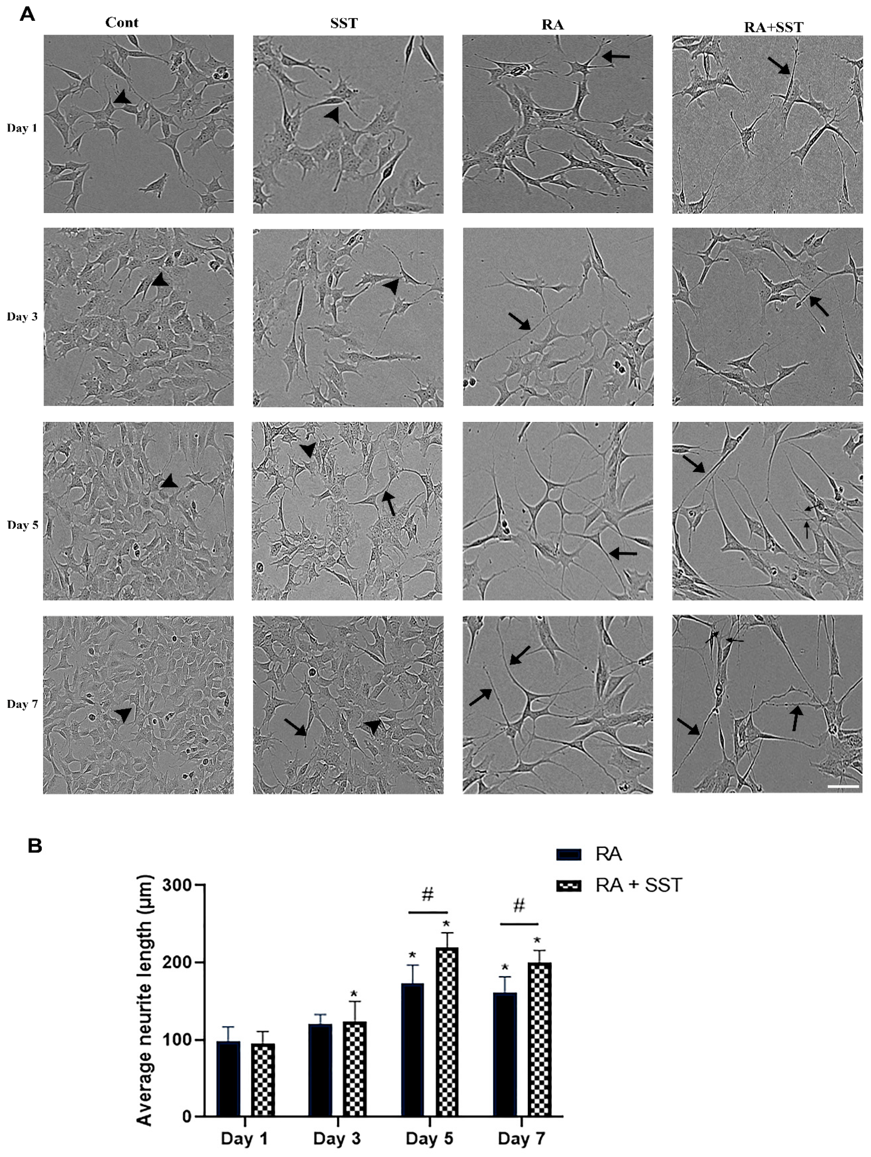 Biomedicines | Free Full-Text | Somatostatin-Mediated Regulation of  Retinoic Acid-Induced Differentiation of SH-SY5Y Cells: Neurotransmitters  Phenotype Characterization | HTML
