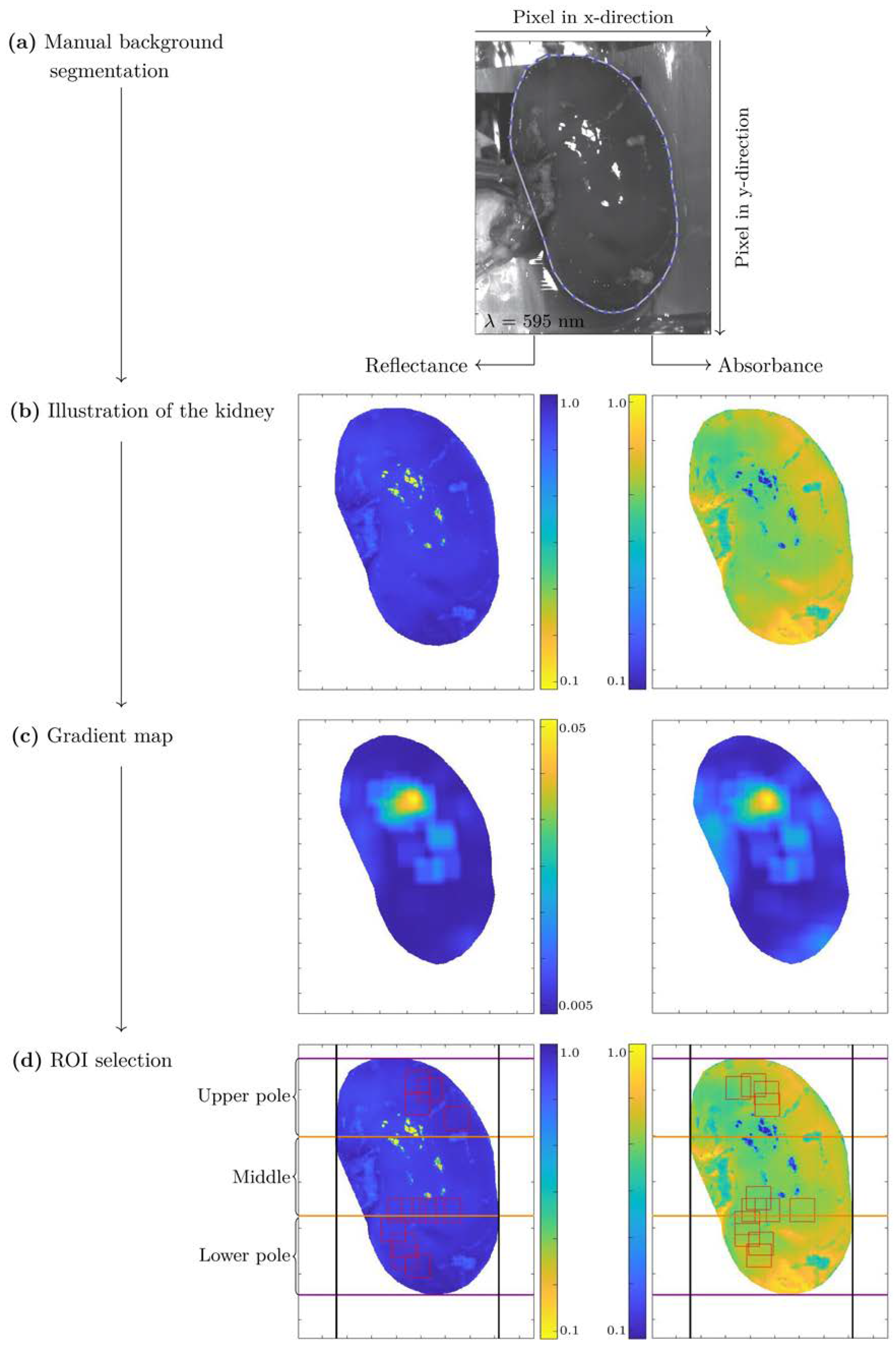 Inspection of visible components in urine based on deep learning